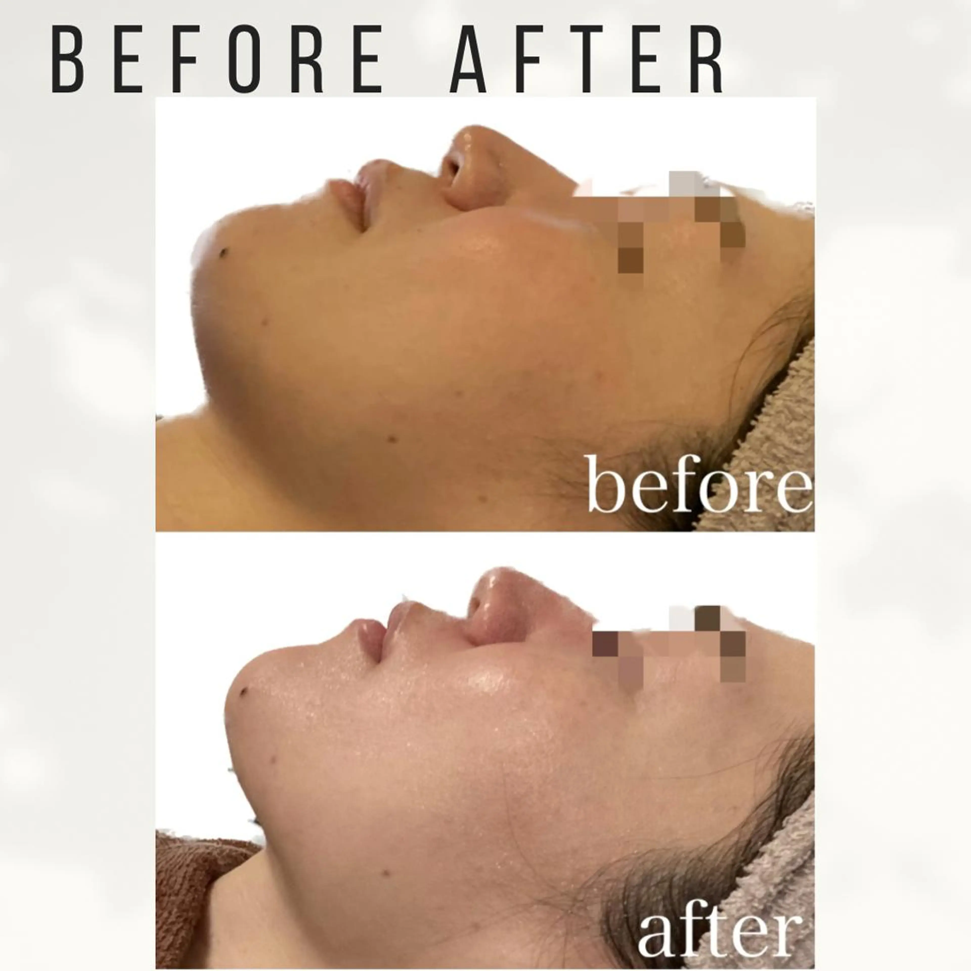 大人女性のための 肌管理サロン　ハピーのエステ・リラクイメージ