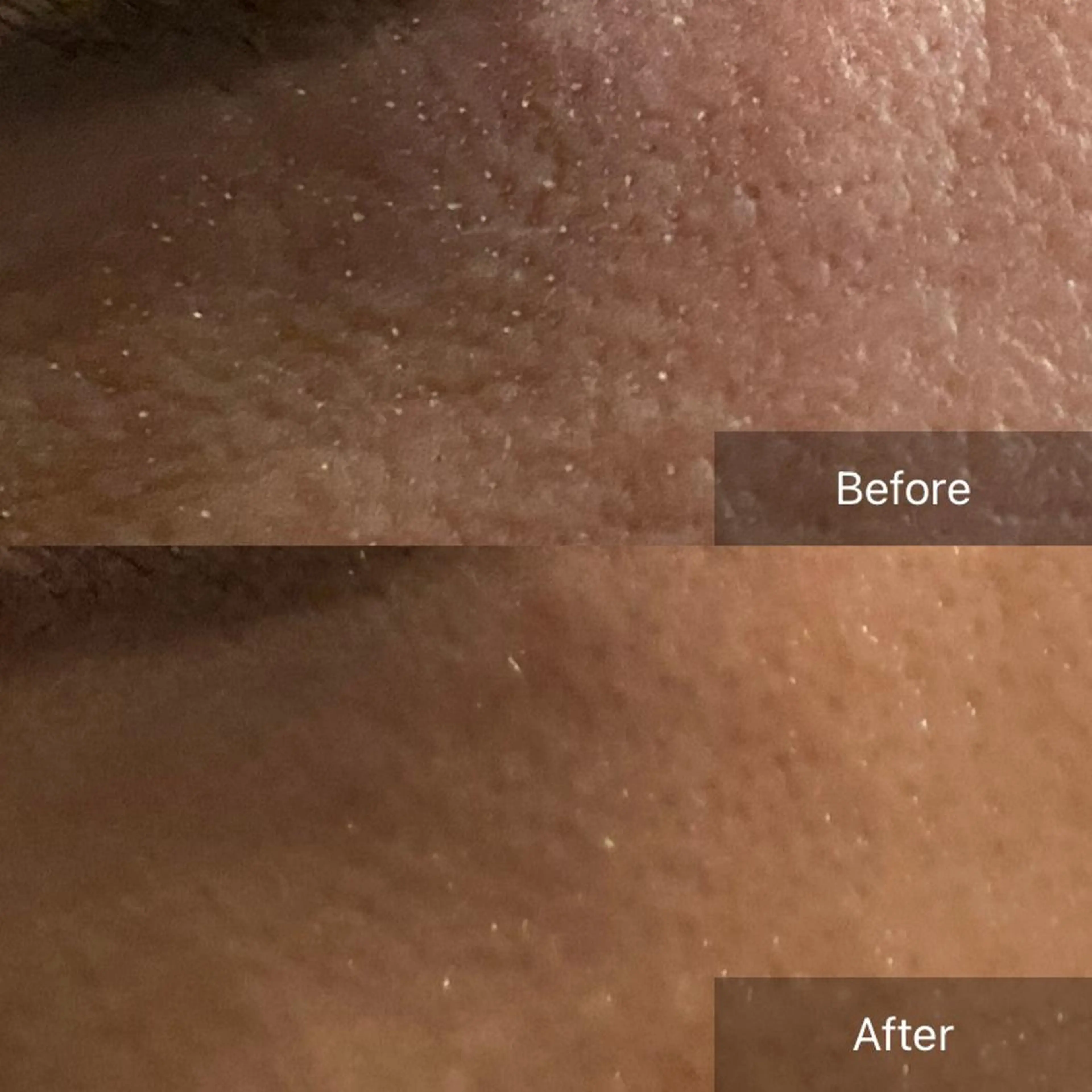 毛穴から始める肌メン テマンダリンオレンジのエステ・リラクイメージ