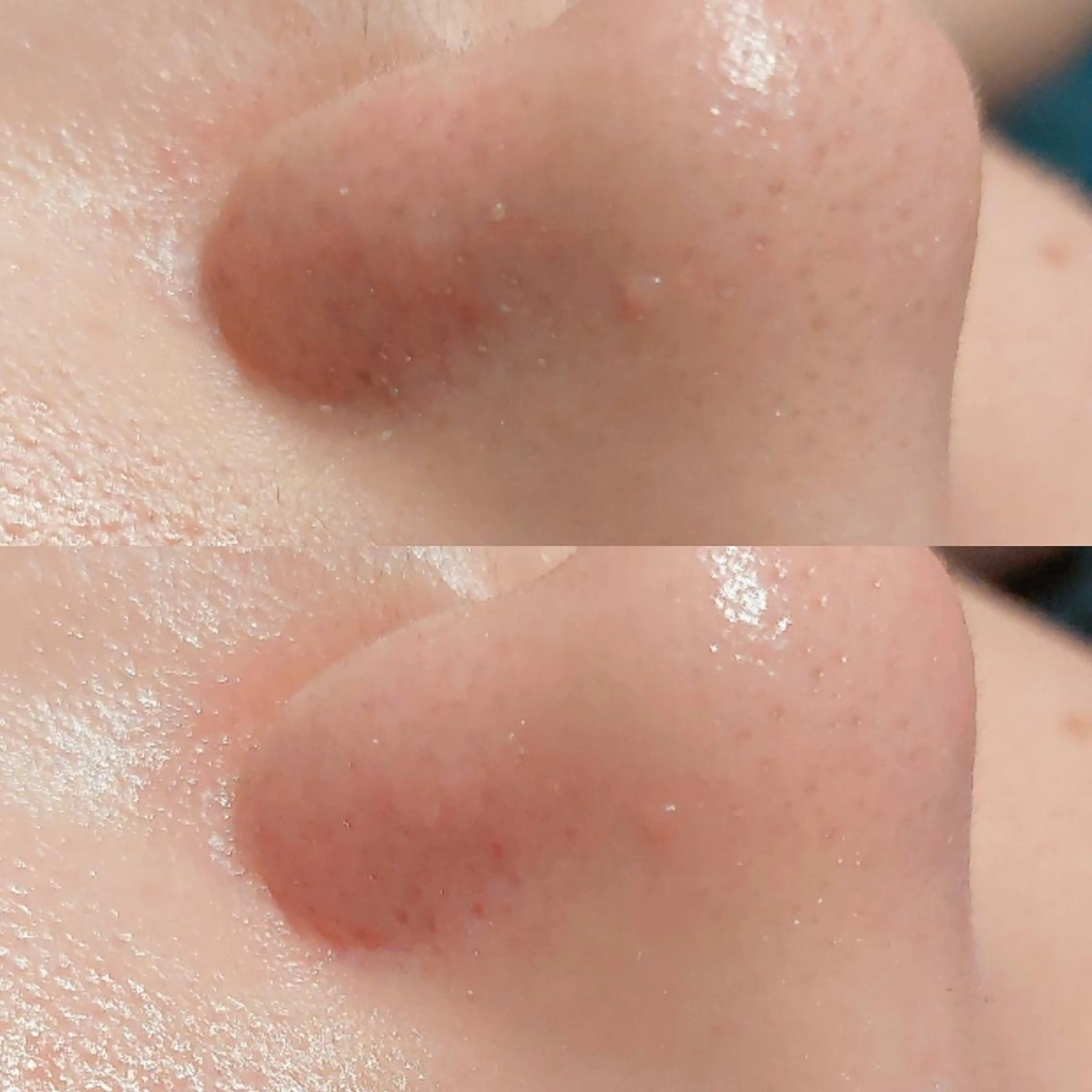 エステ MyFairLady miuのエステ・リラクイメージ