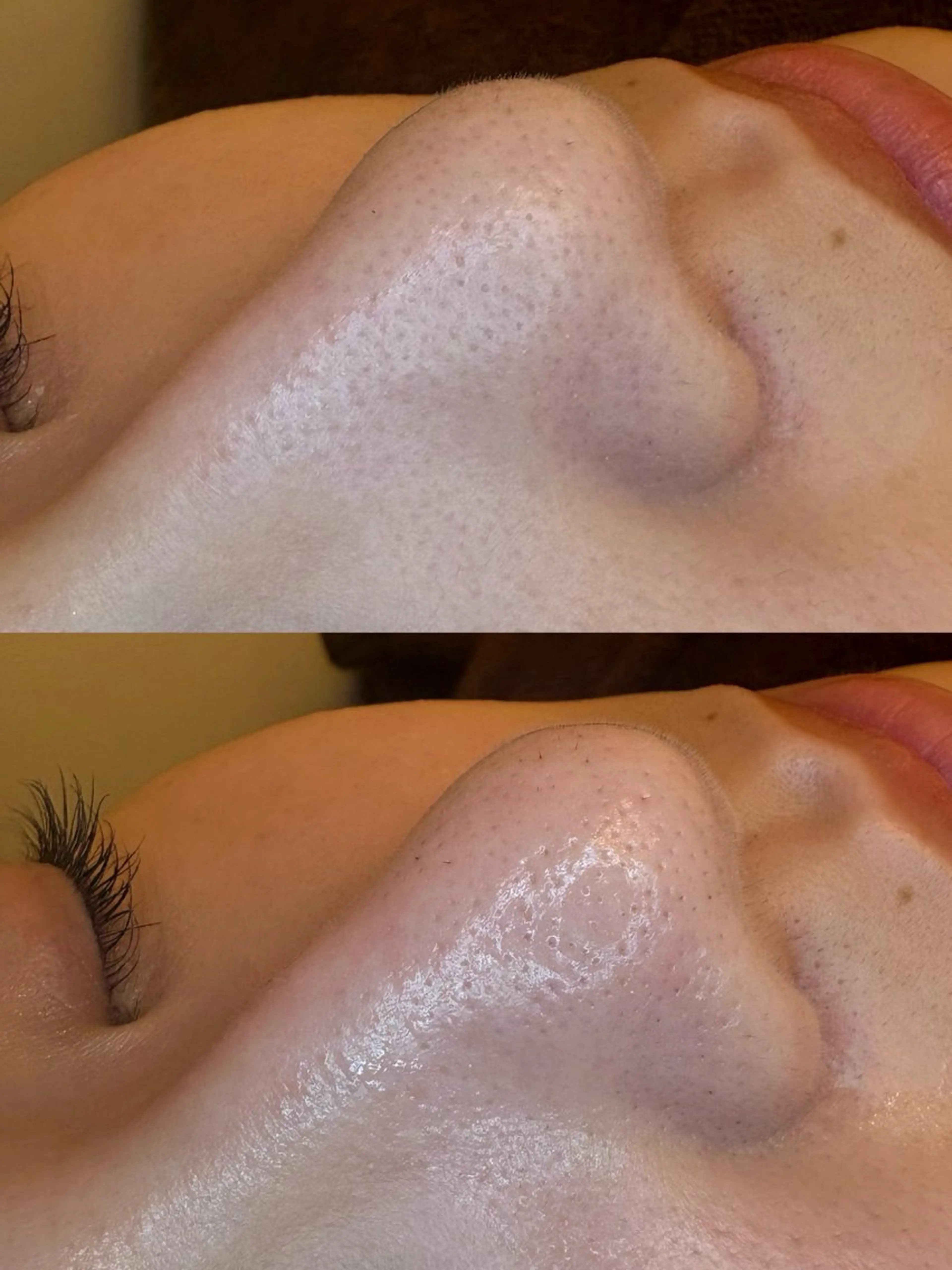 🤍アベシュリ /フェイシャル🤍のエステ・リラクイメージ