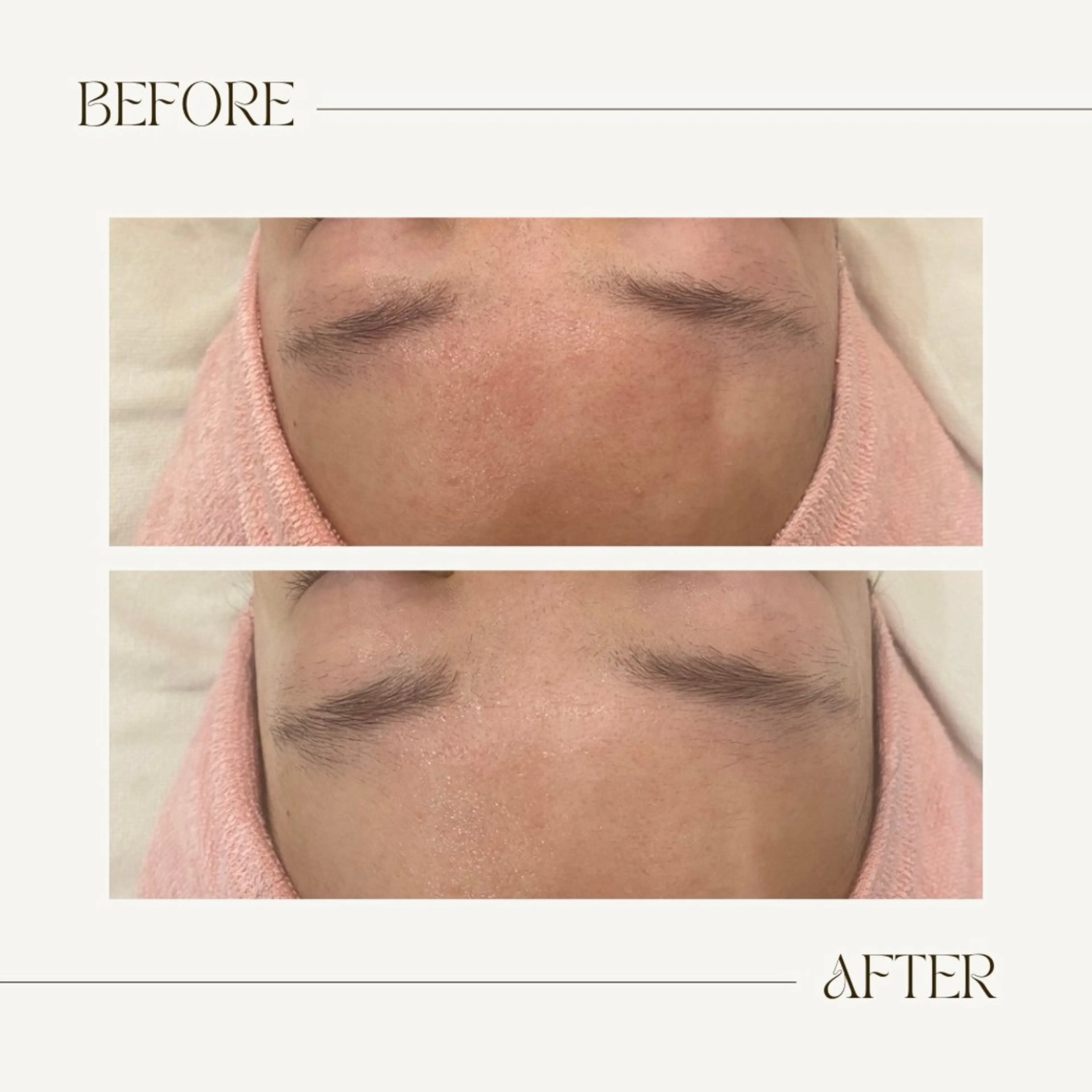 CEsalonEgg 齋藤のエステ・リラクイメージ