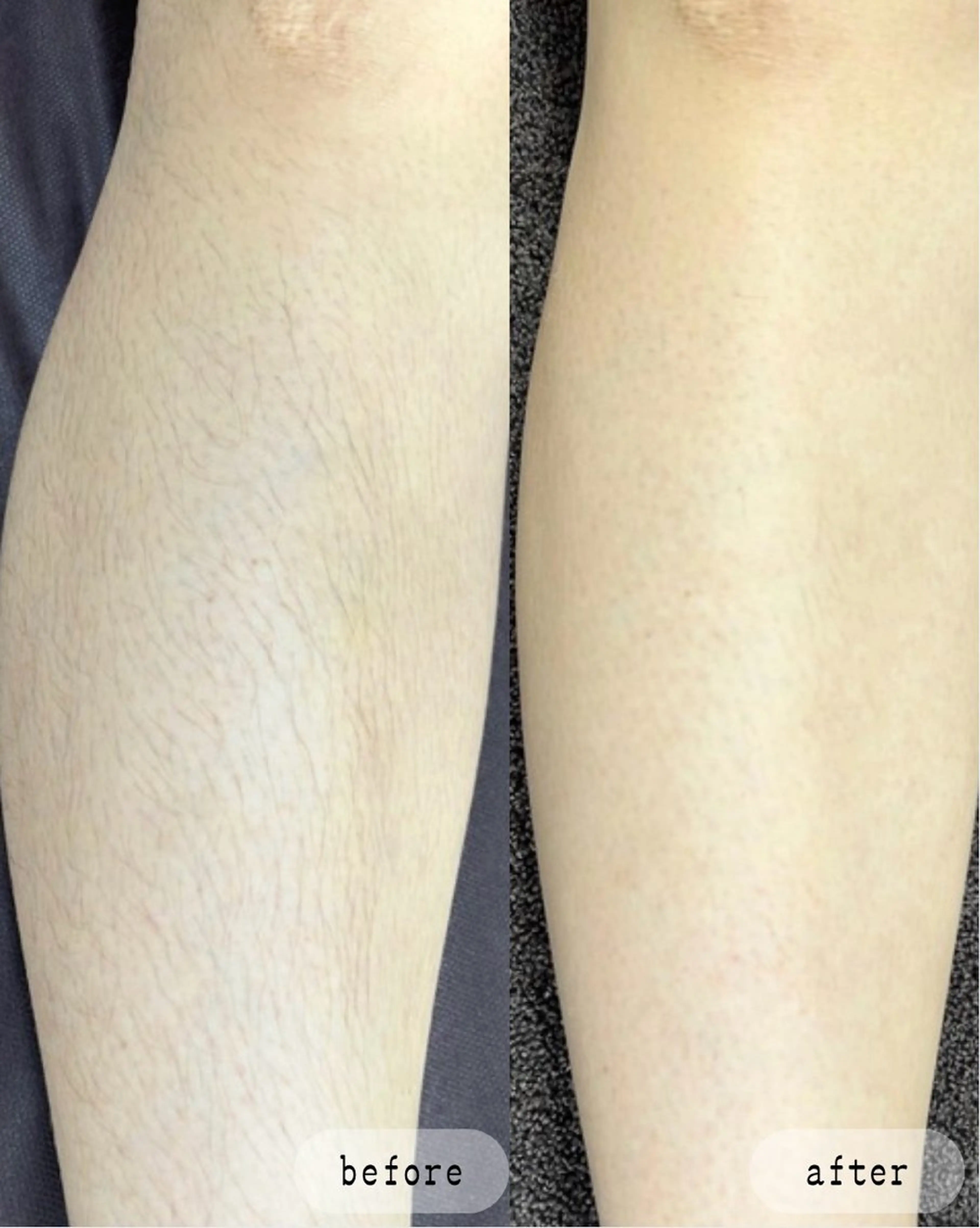 脱毛 LaVibe ann.のエステ・リラクイメージ