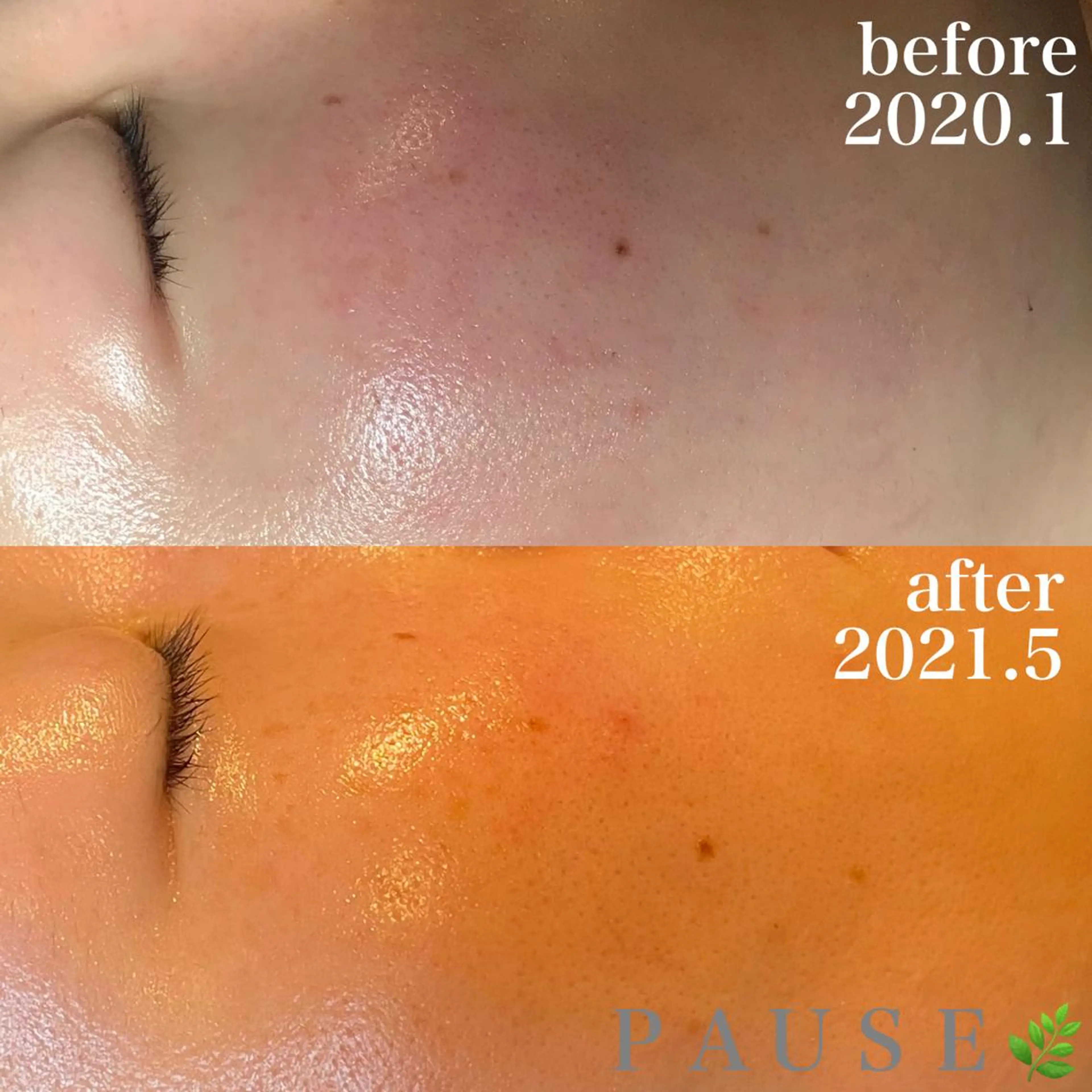 エステ 浜野 恵美のエステ・リラクイメージ