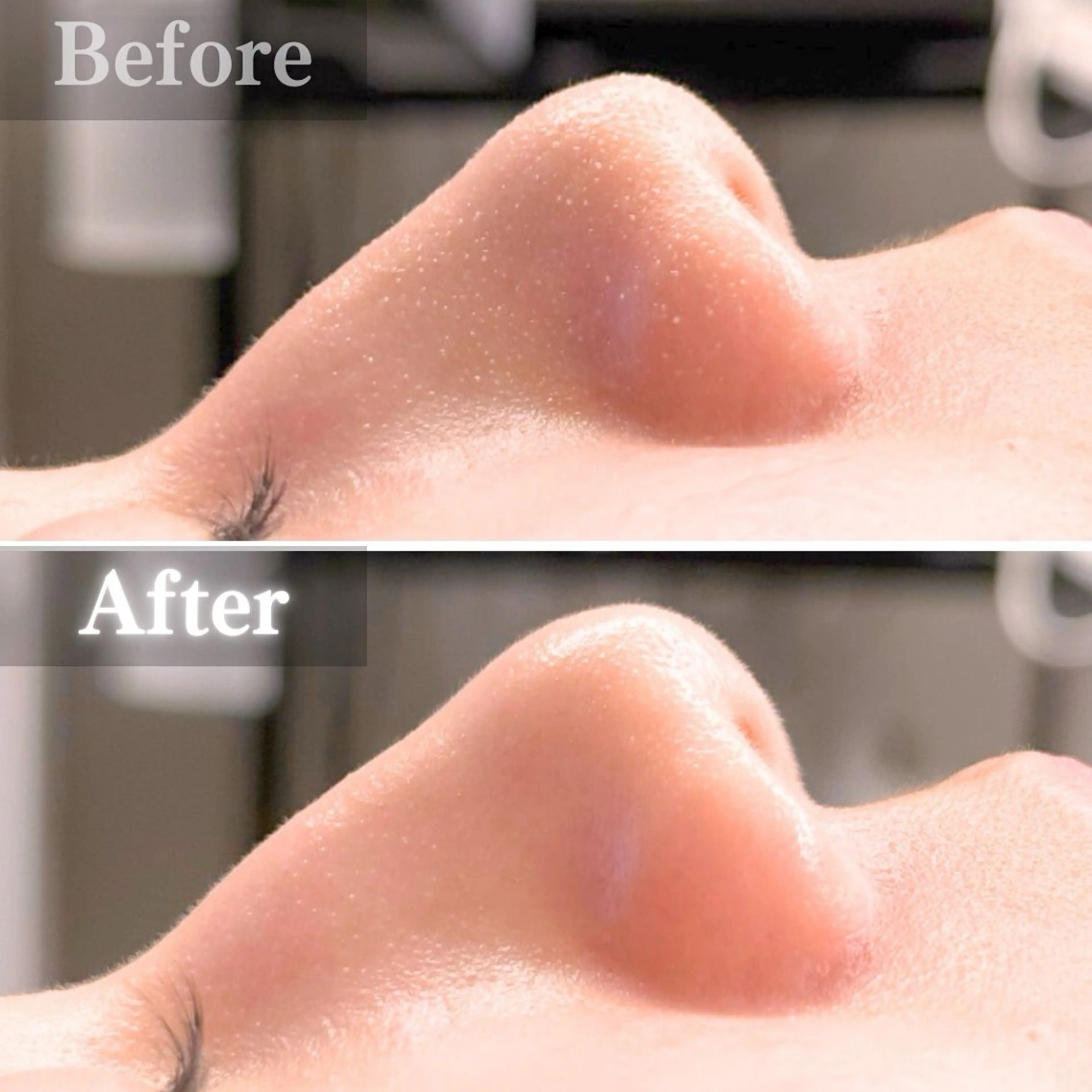 エステ 毛穴洗浄特化🫧 オオツカのエステ・リラクイメージ