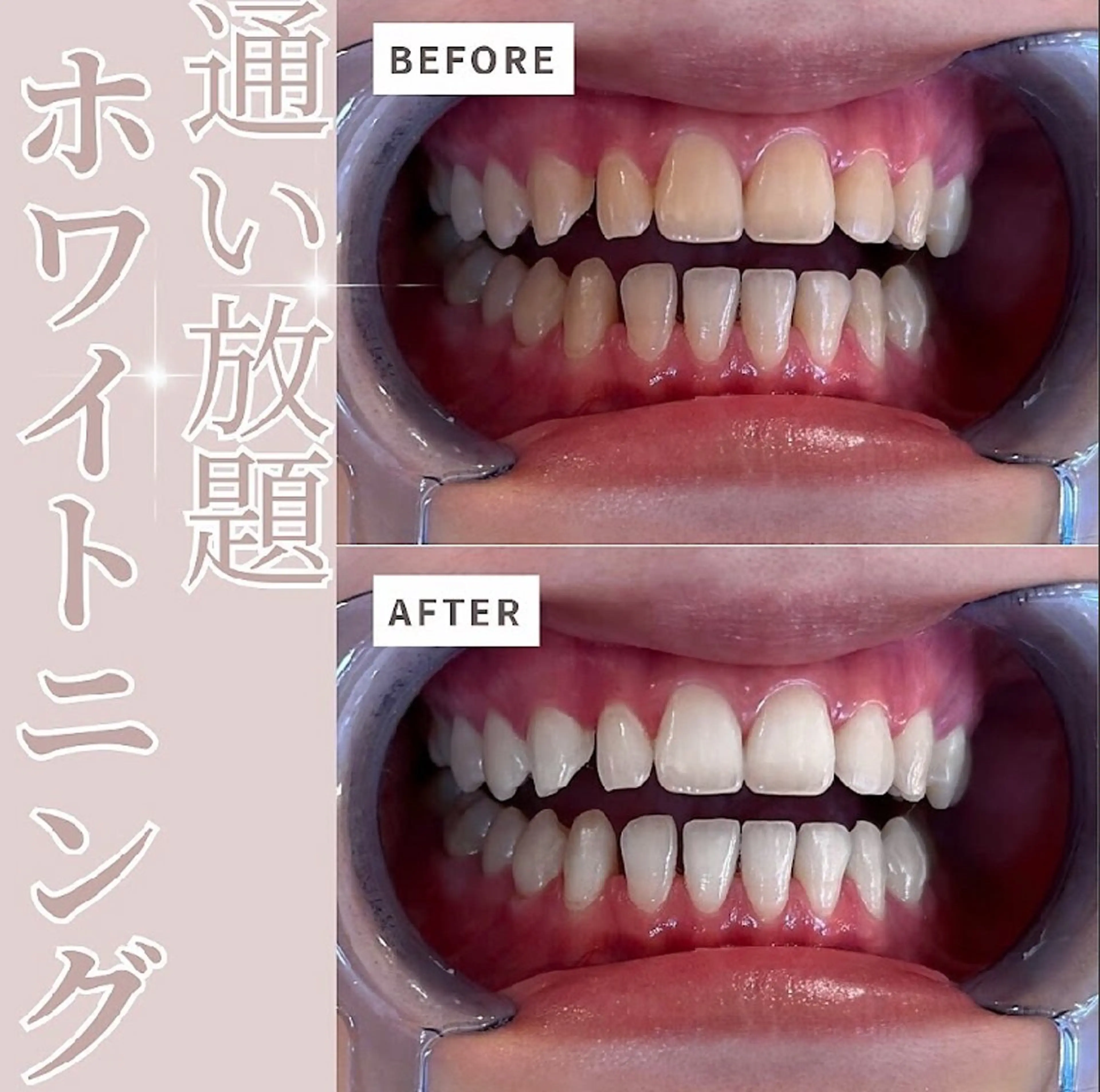 その他 nanami -ホワイトニングのその他イメージ