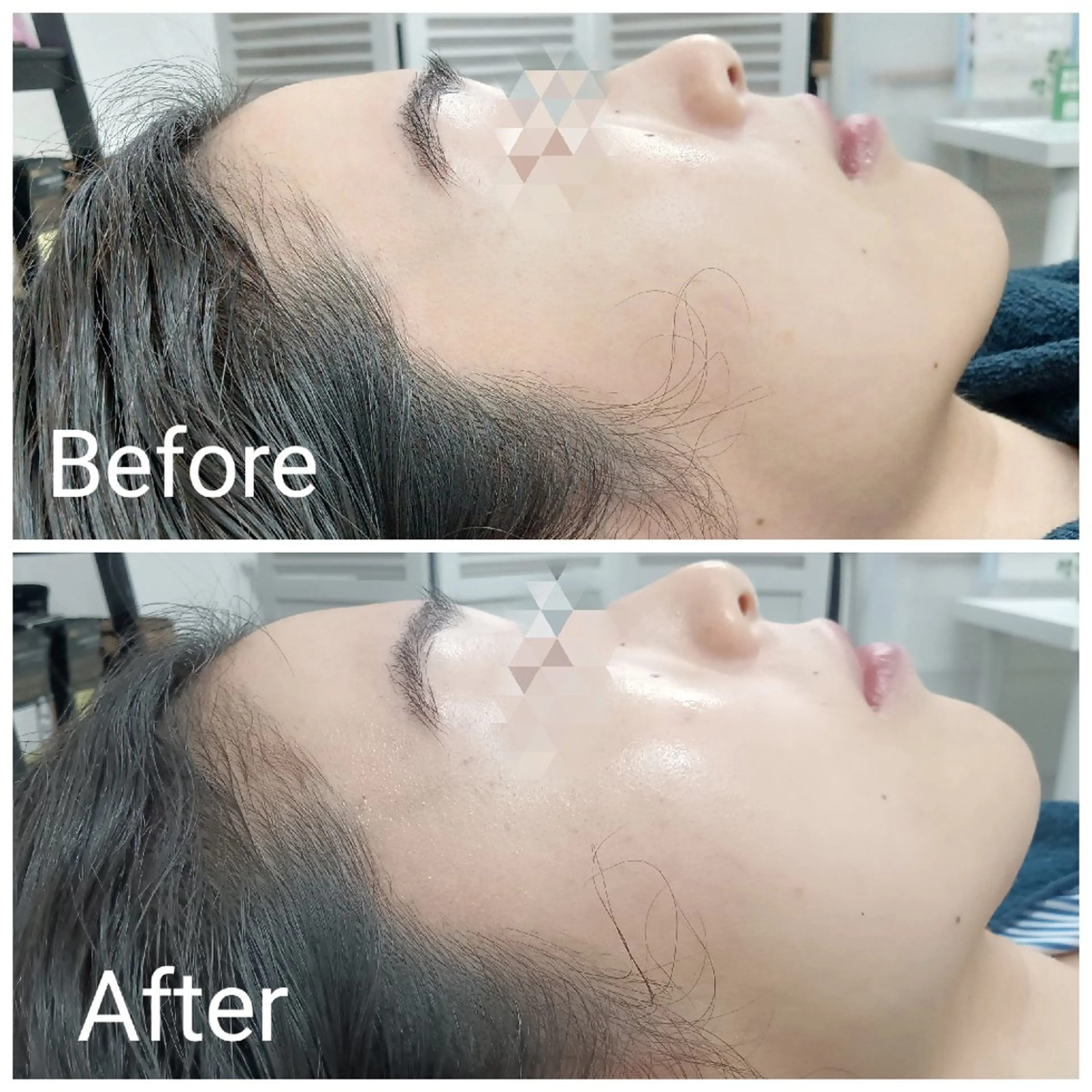 エステ リラク 肌質改善Beauty salon Renのエステ・リラクイメージ