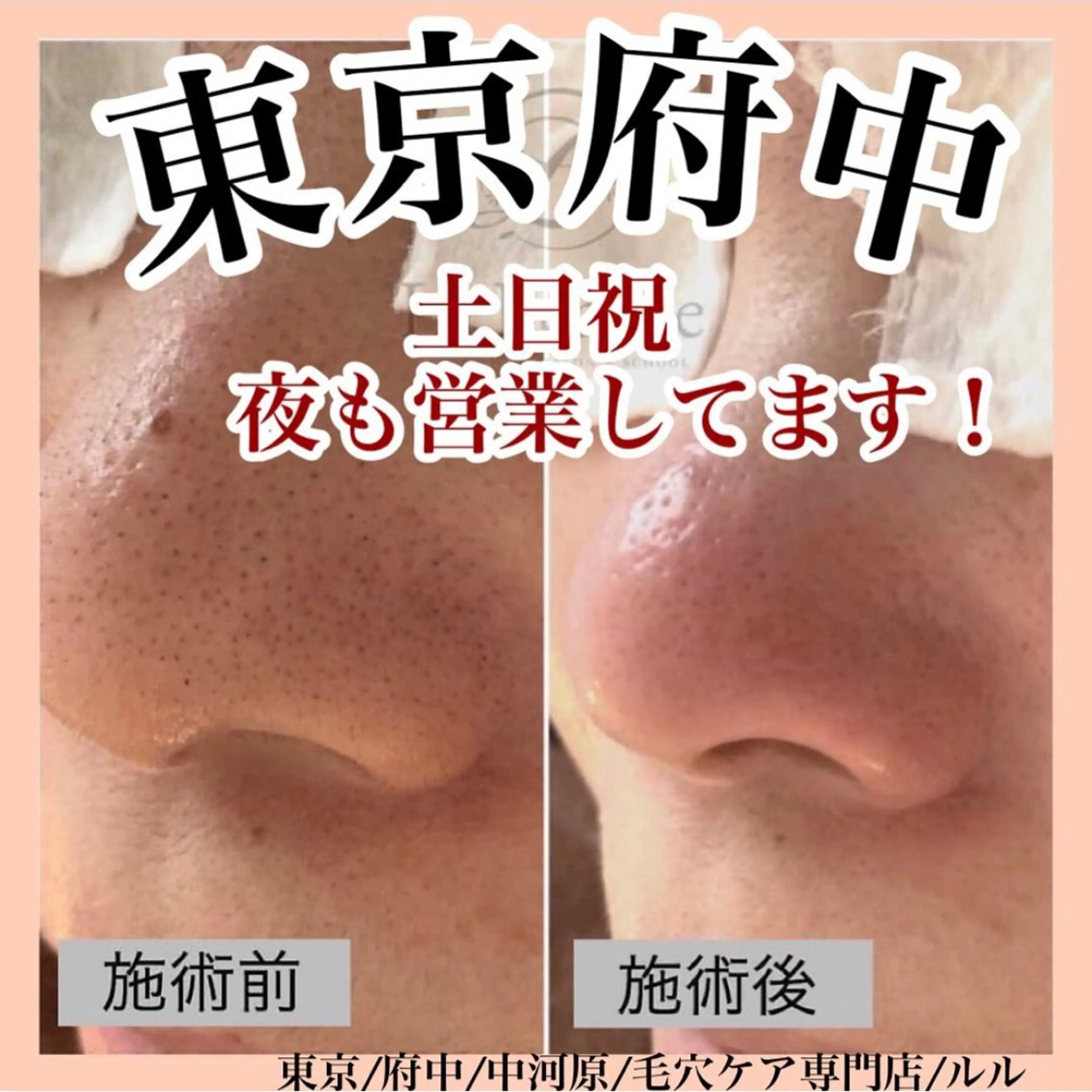 エステ LULU ルルのエステ・リラクイメージ