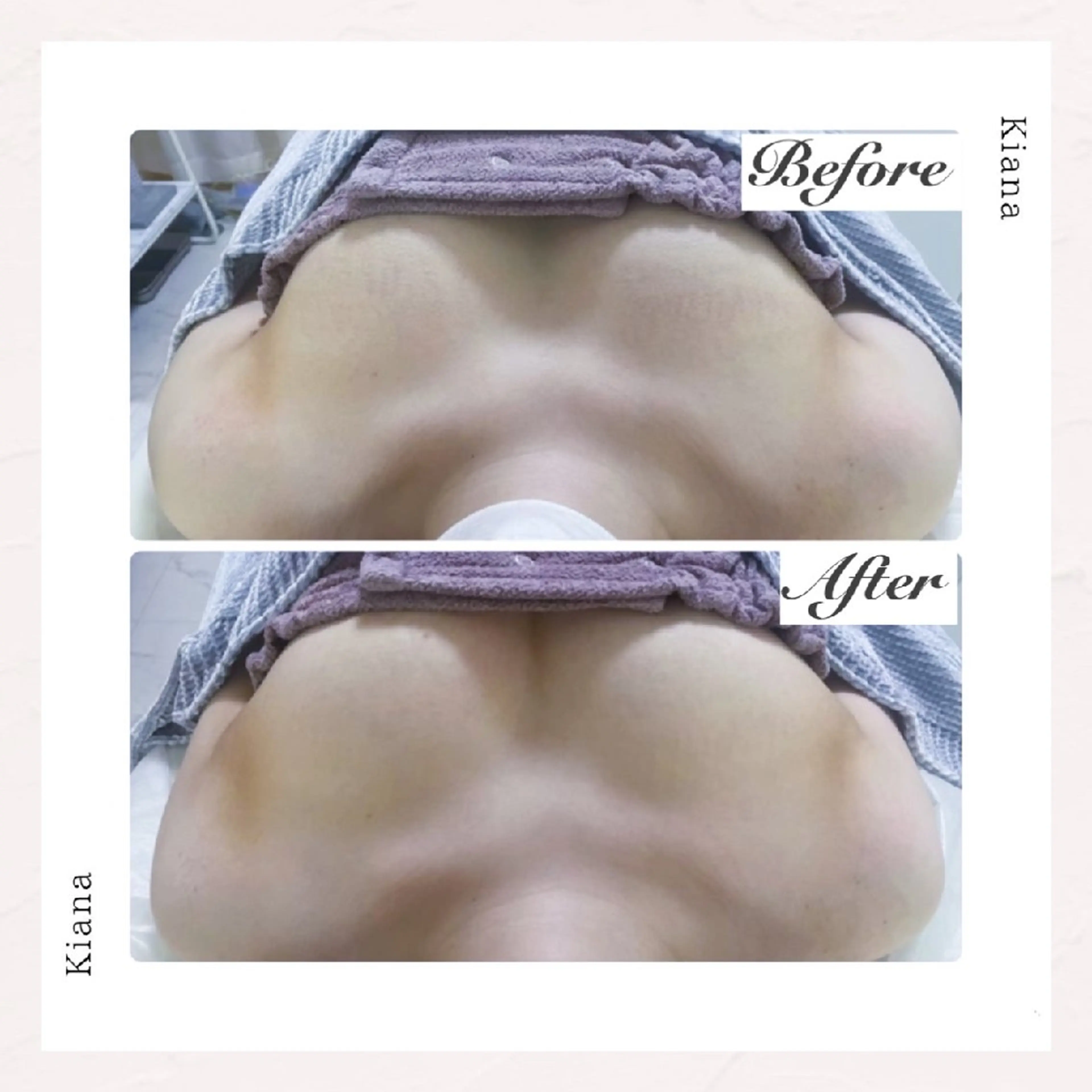 【バスト専門店 】 Kiana のエステ・リラクイメージ