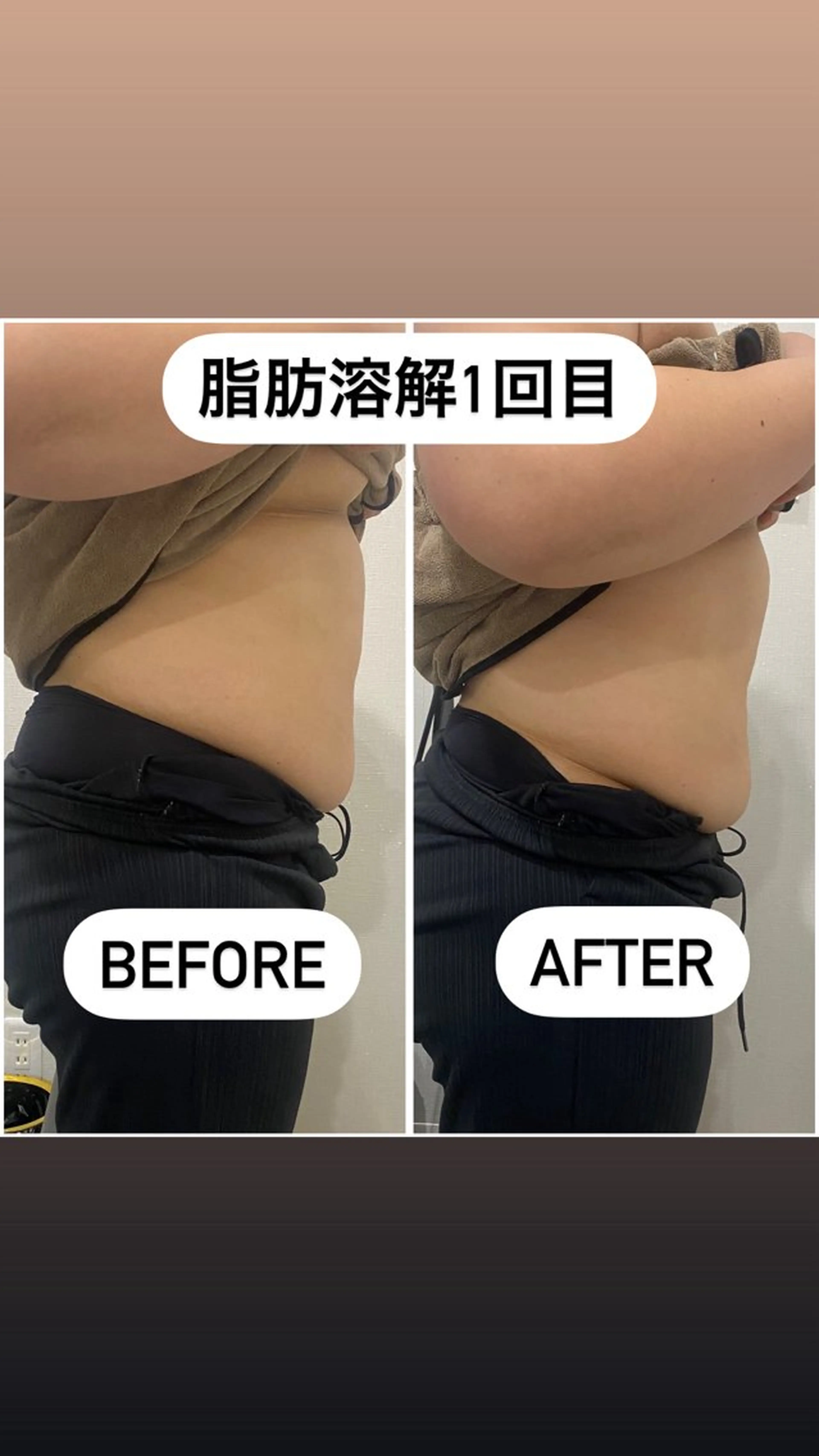 エステ 毛穴洗浄・痩身・脱毛 /アルカンジュのエステ・リラクイメージ