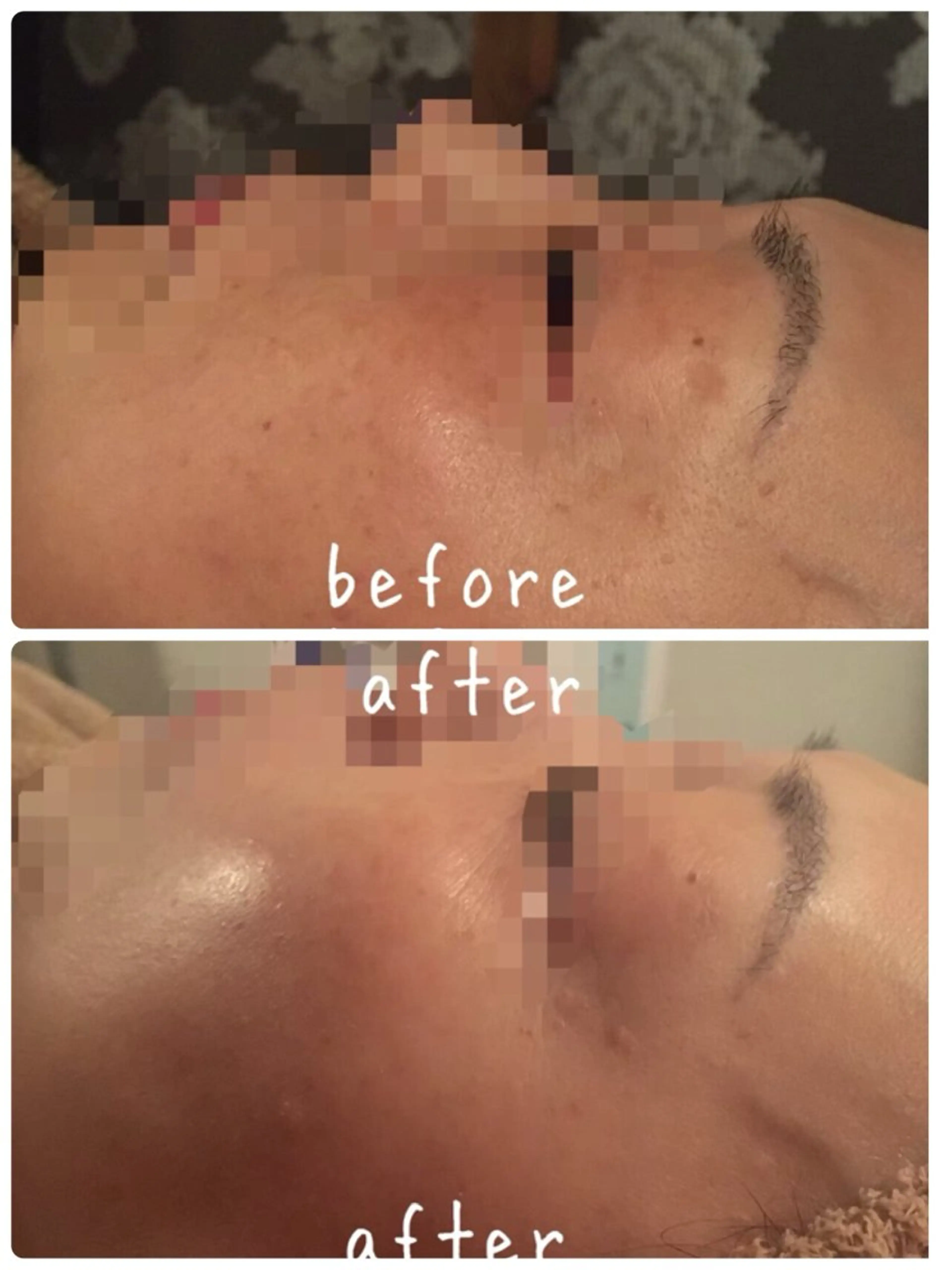 エステ エステティック sala藤沢のエステ・リラクイメージ