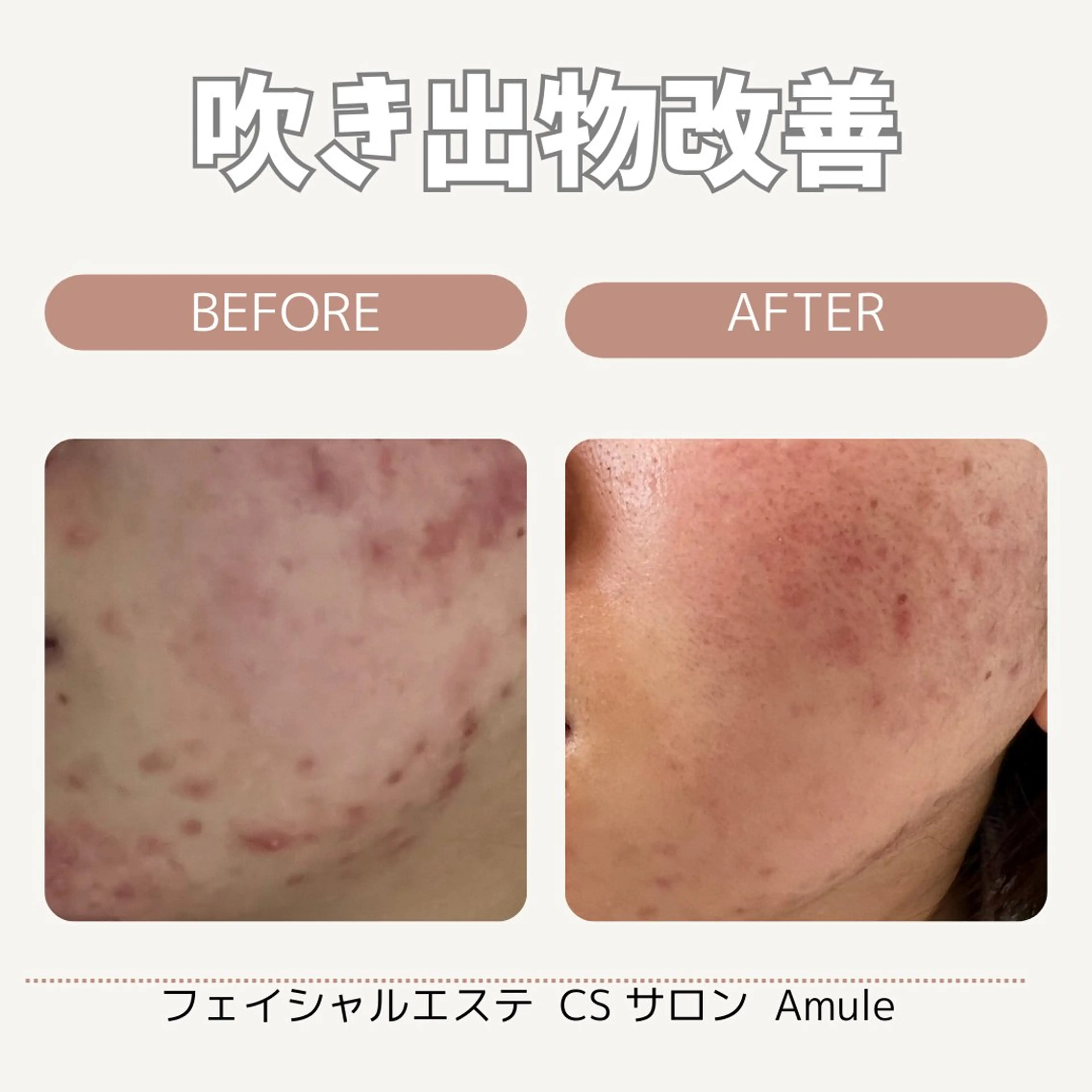 CSサロン Amule所属・Amule anna🦋のエステ・リラクイメージ