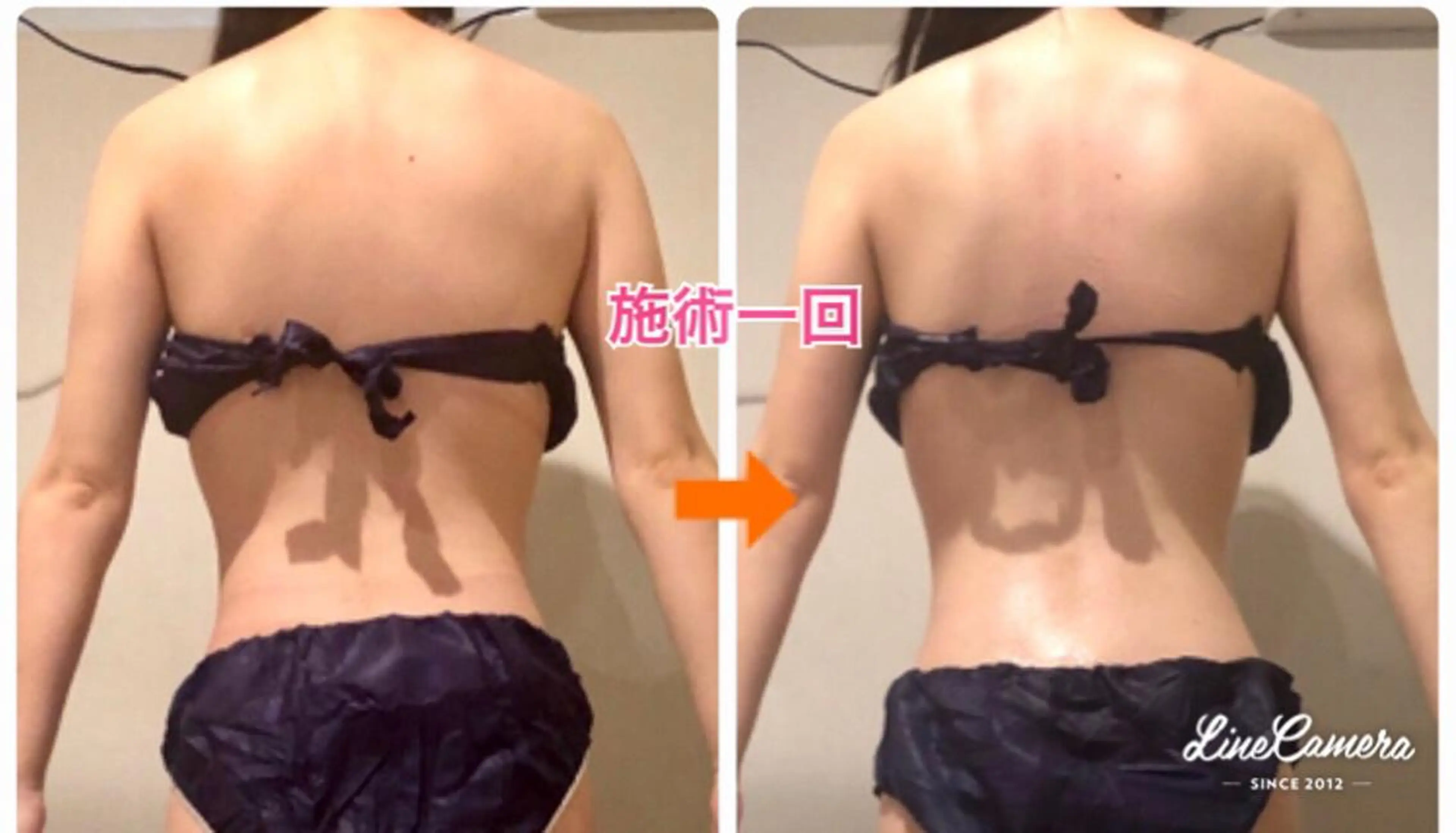 ショート カラー パーマ ヘアアレンジ メンズ キッズ ネイル マツエク・マツパ ‍痩身＆ボディ 結果出し🌟丹野のエステ・リラクイメージ