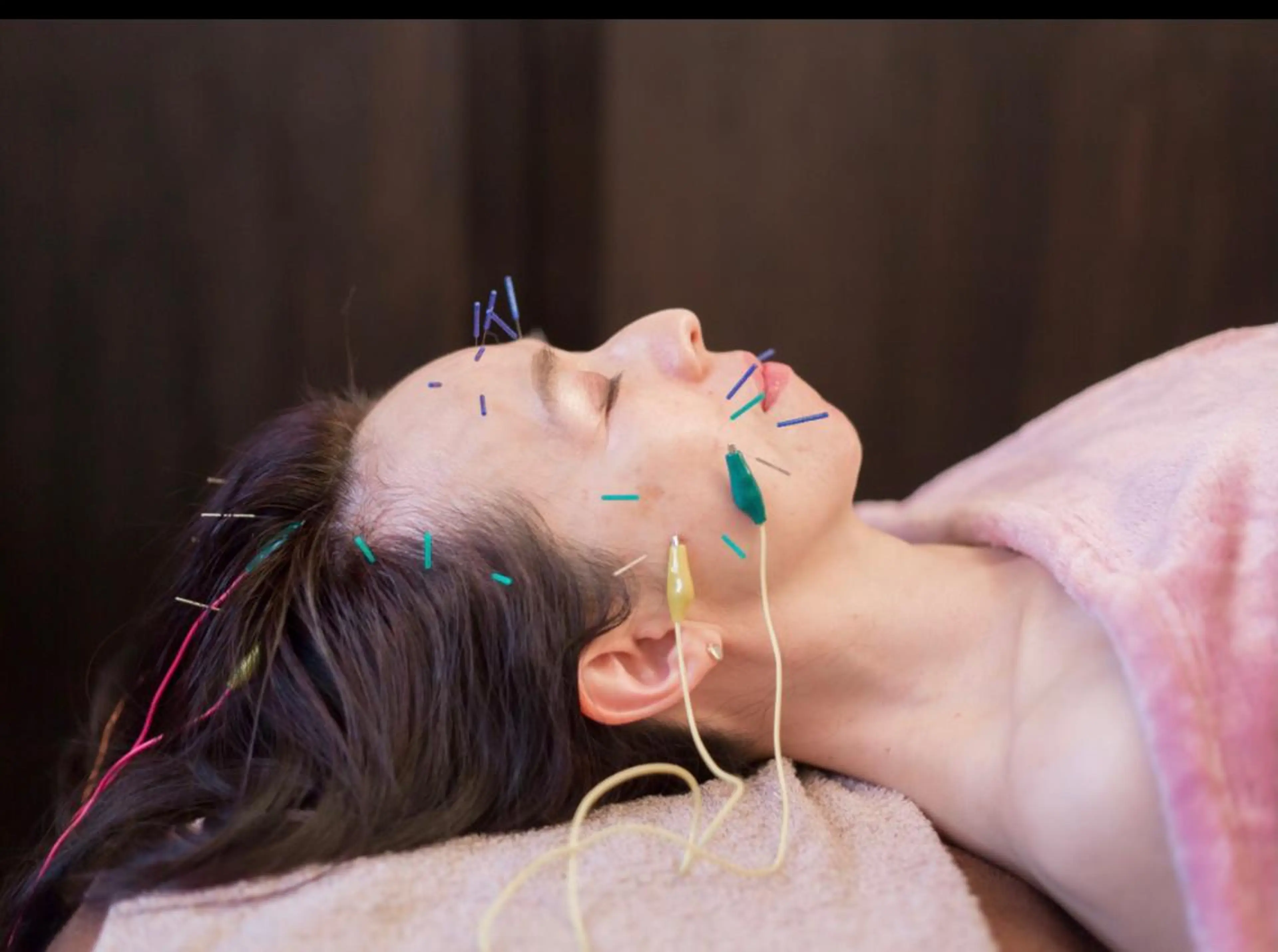 美容鍼サロン    Fleurir所属・伊藤 かなえのエステ・リラクイメージ