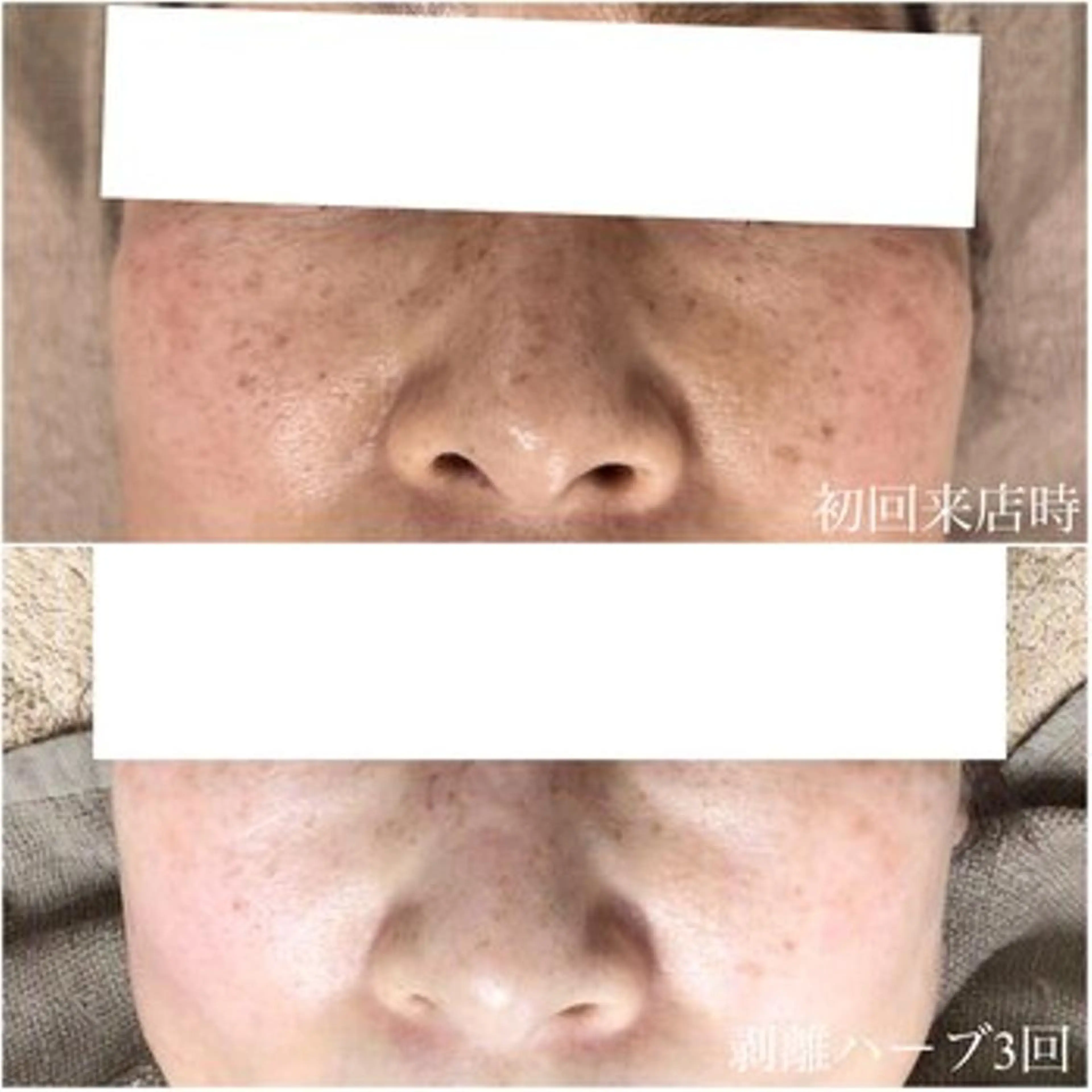 毛穴/毛穴洗浄専門 エミルカ船橋のエステ・リラクイメージ