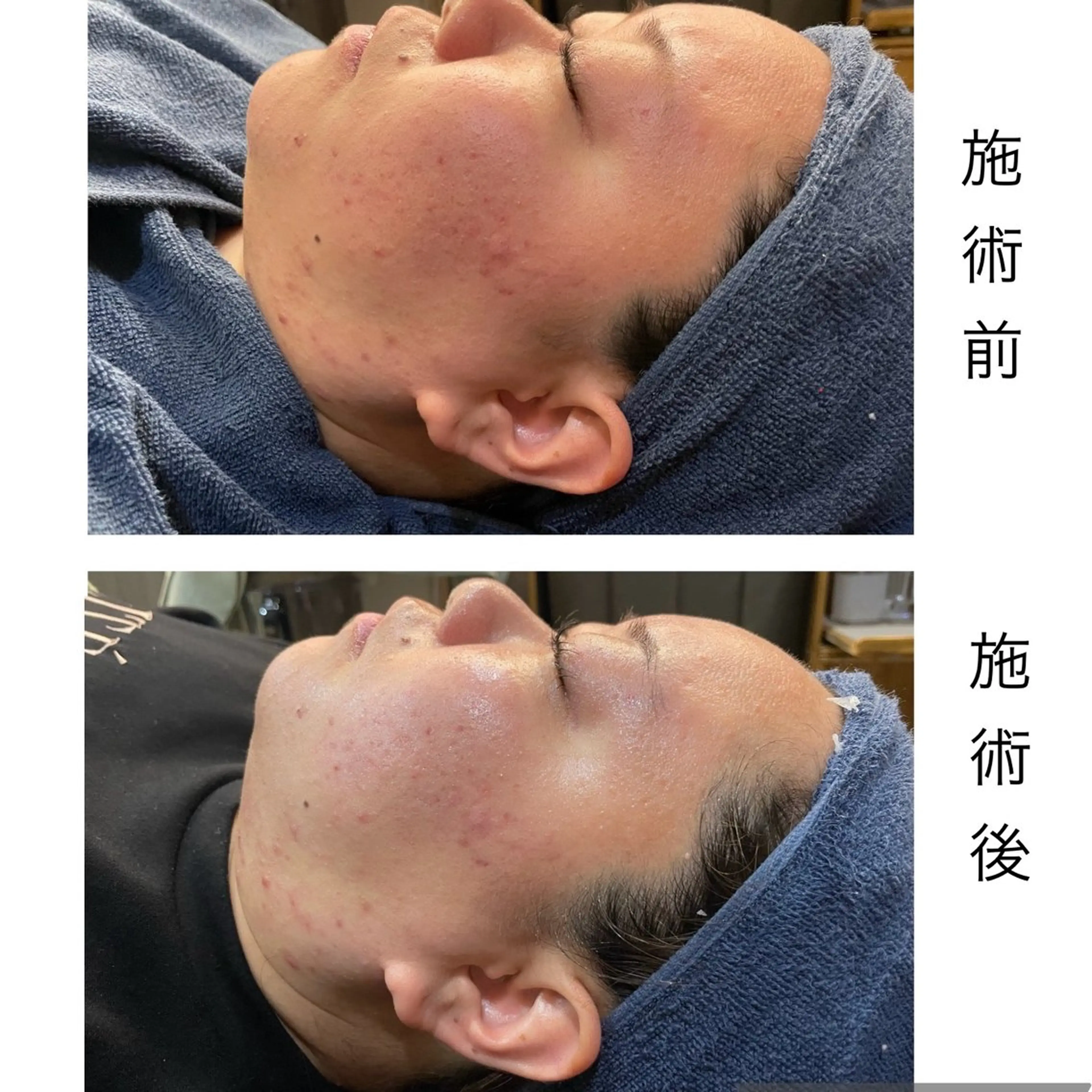 leolo武蔵浦和 肌質改善＆脱毛のエステ・リラクイメージ