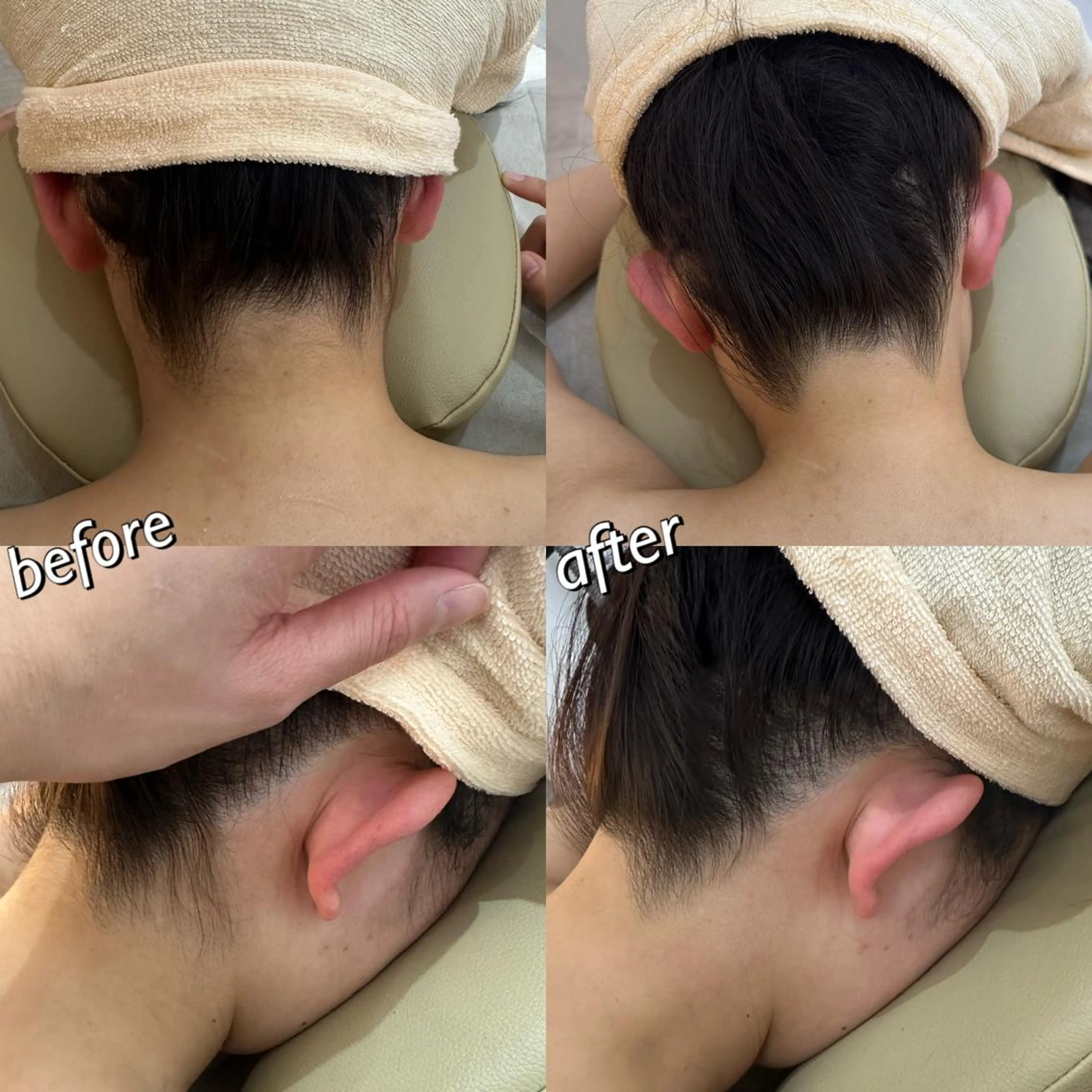 うなじ脱毛/美肌脱毛 LABELのエステ・リラクイメージ