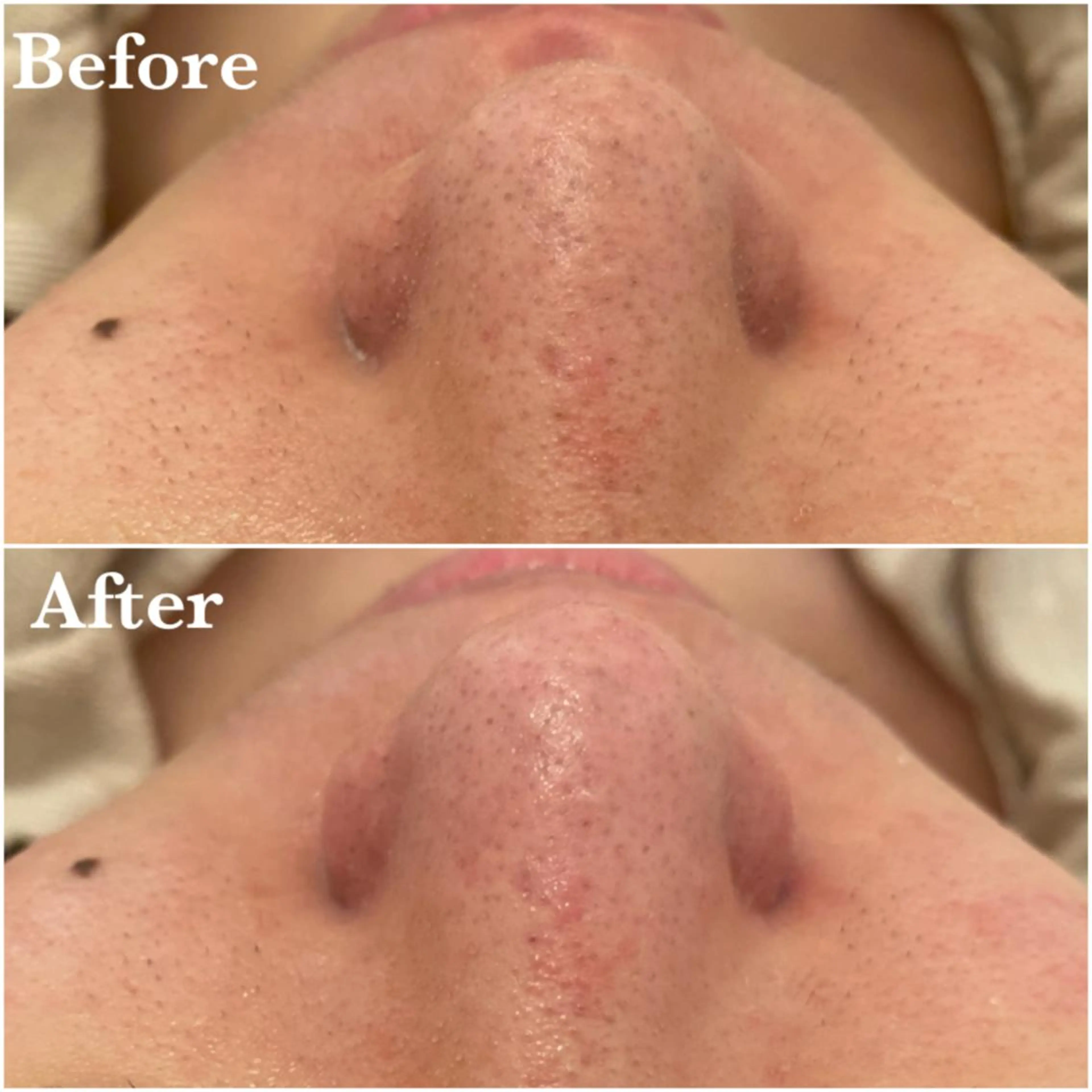 ララ/ハーブ メゾンリュバンのエステ・リラクイメージ