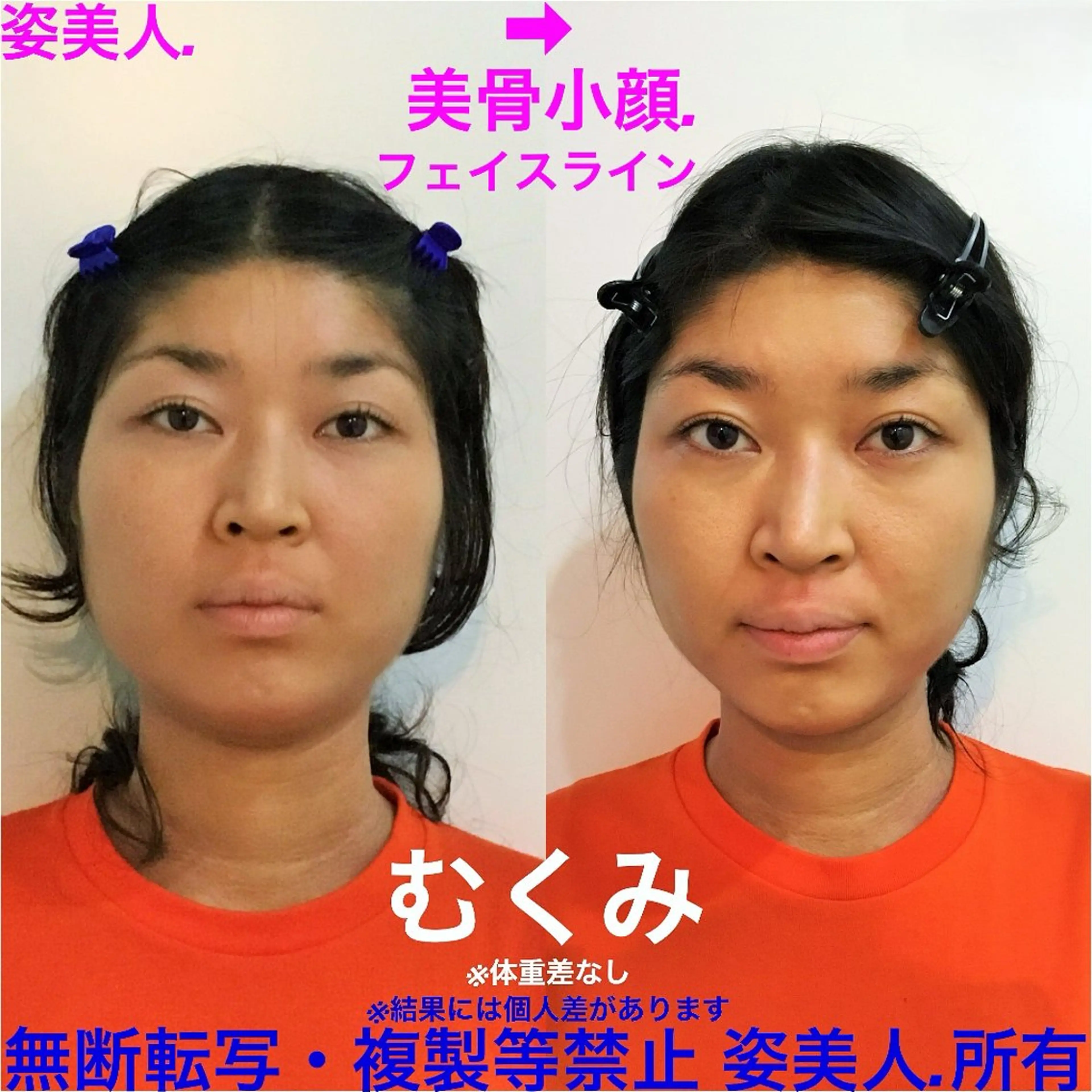 筋膜整体＆小顔矯正 　姿美人.シルエットのエステ・リラクイメージ
