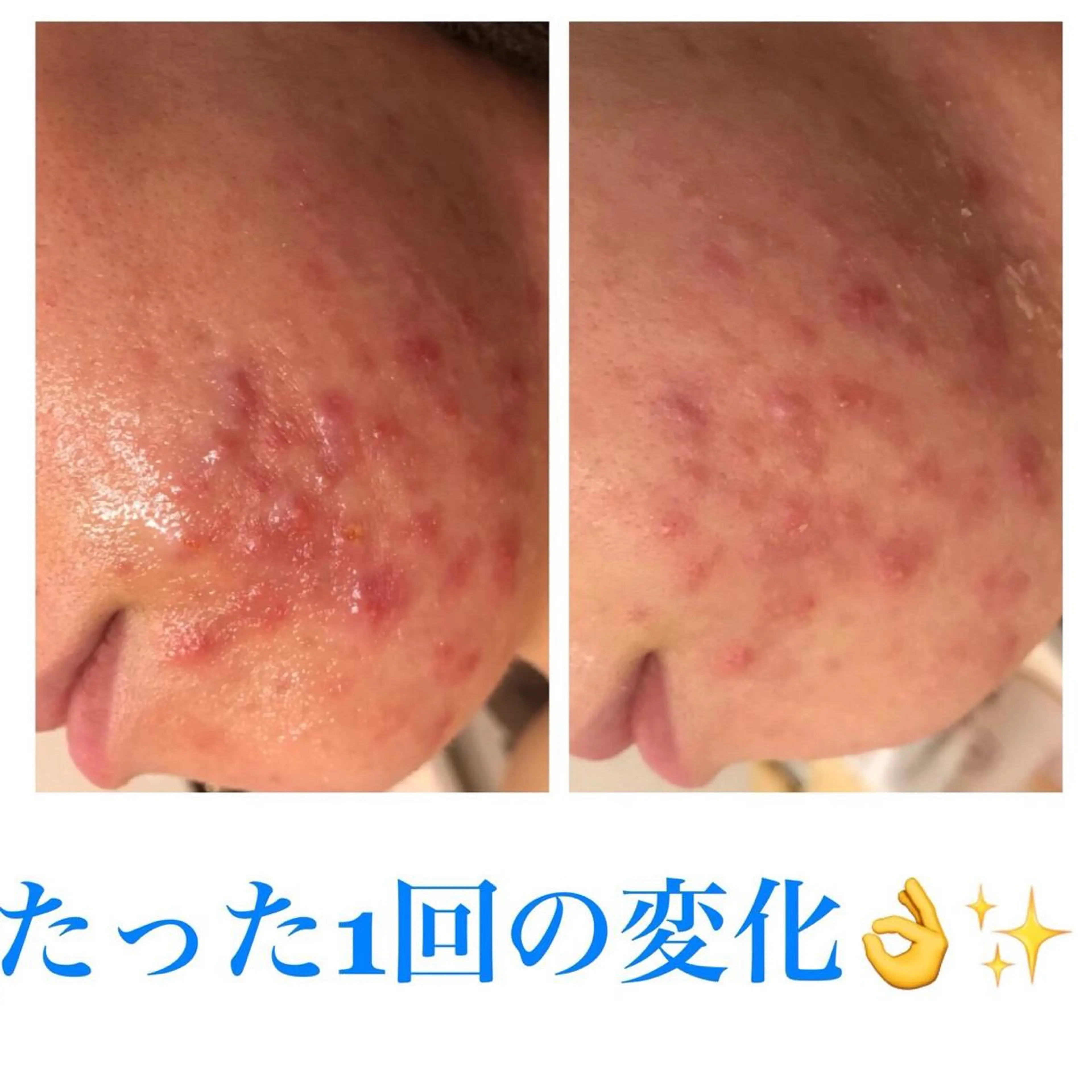 ミディアム カラー パーマ ヘアアレンジ メンズ ネイル マツエク・マツパ ニキビ・肌質改善専門 ♡人生が変わるサロンのエステ・リラクイメージ