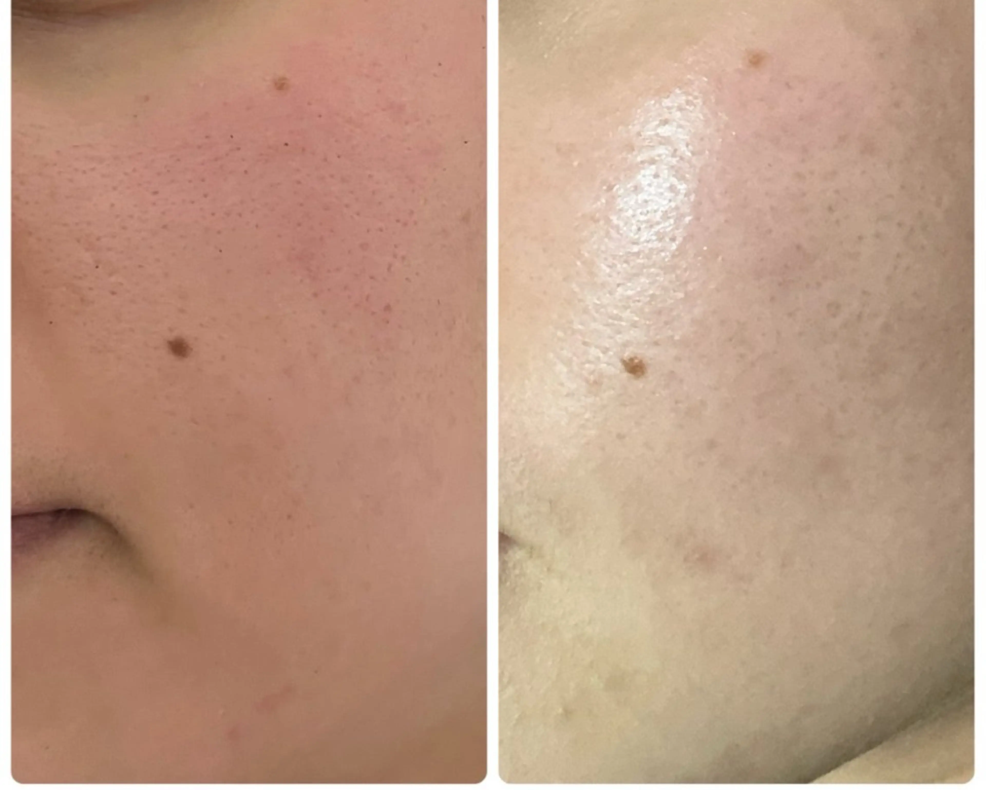 エステ 美肌脱毛サロン muroのエステ・リラクイメージ