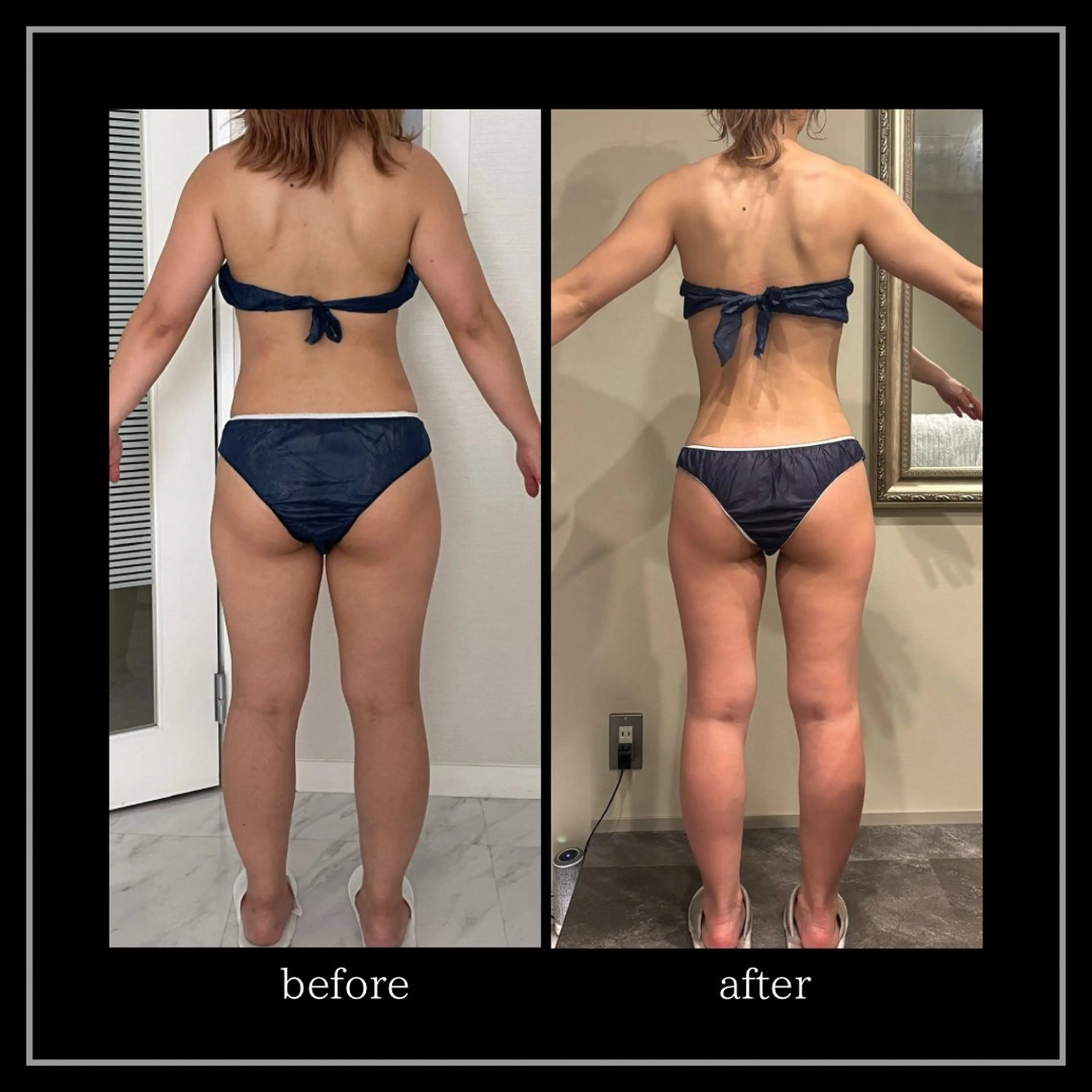 オフ:オン 全身筋膜マッサージのエステ・リラクイメージ