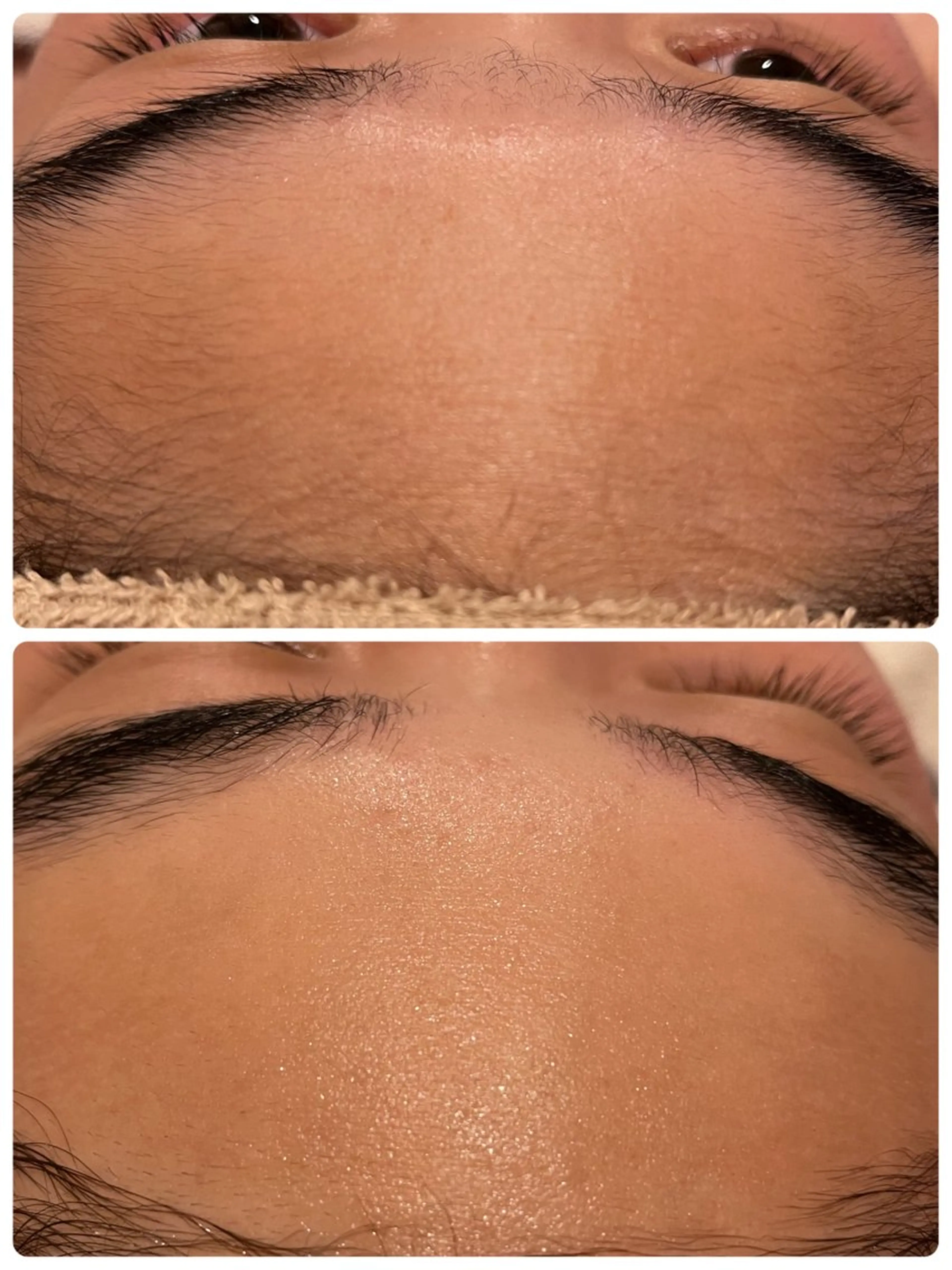 脱毛 LUKE （ルーク）のエステ・リラクイメージ