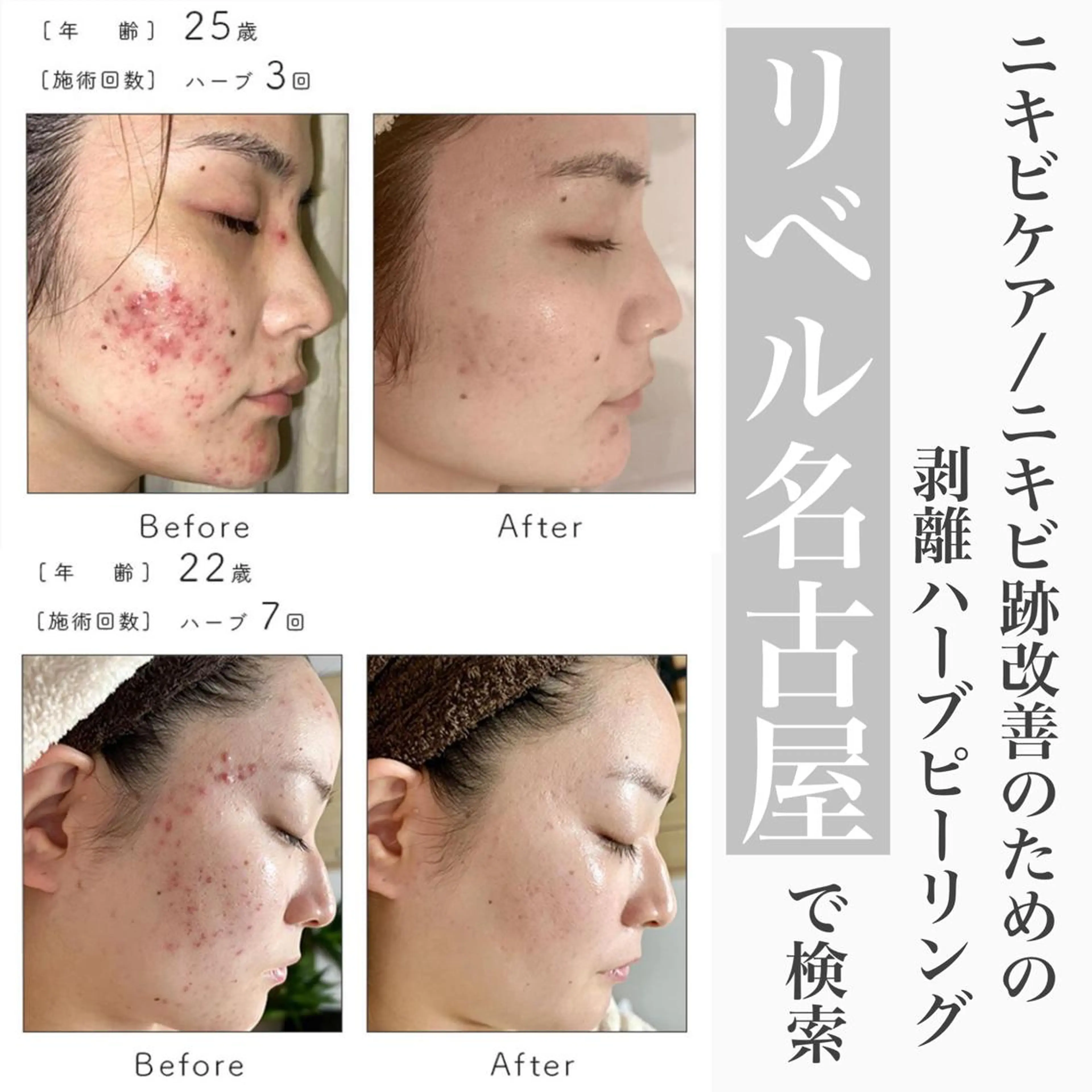 パーマ メンズ マツエク・マツパ エステ 次世代まつげパーマは 『リベル名古屋』のマツエク・マツパデザイン