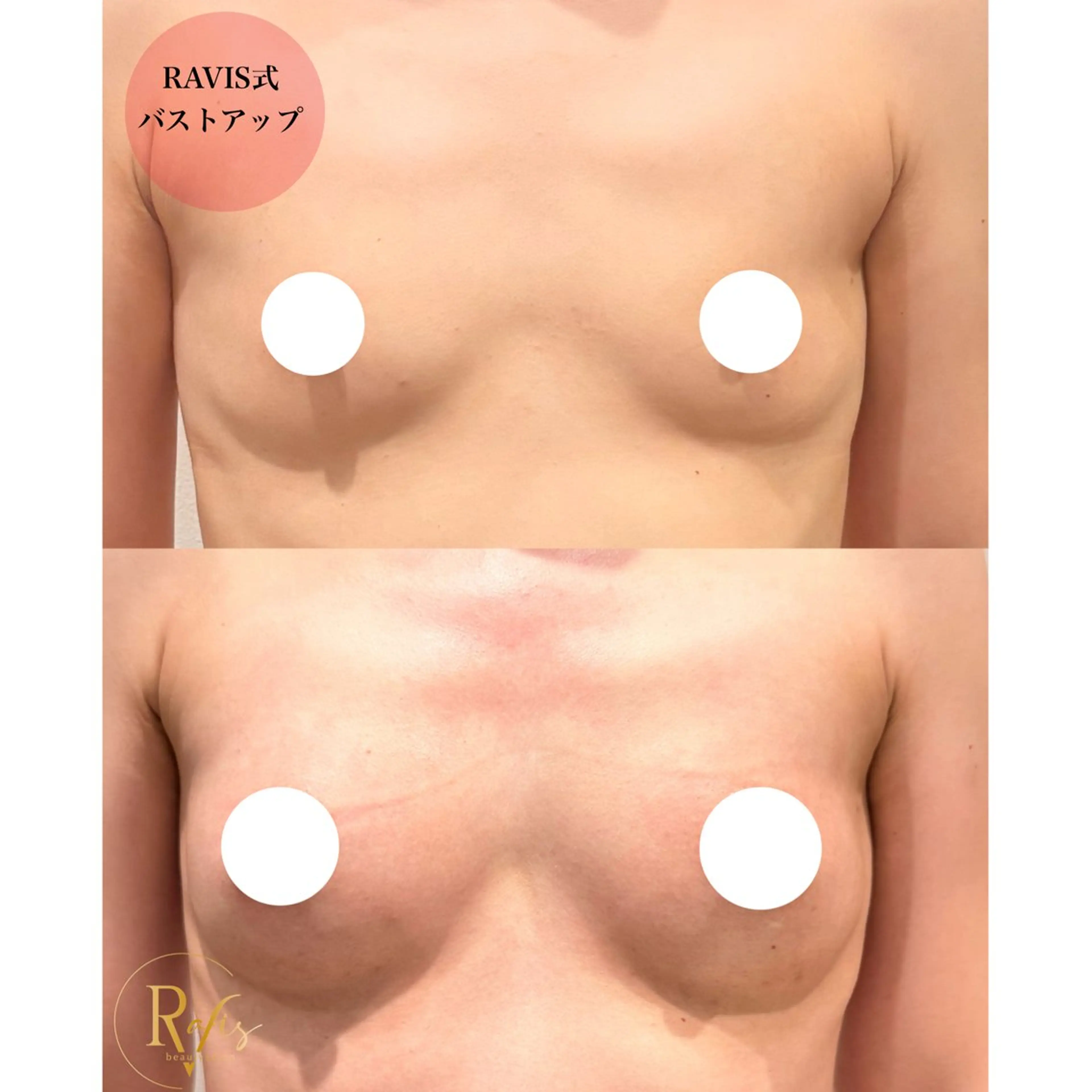 エステ 東大阪/韓国肌管理/ 痩身バスト専門店のエステ・リラクイメージ