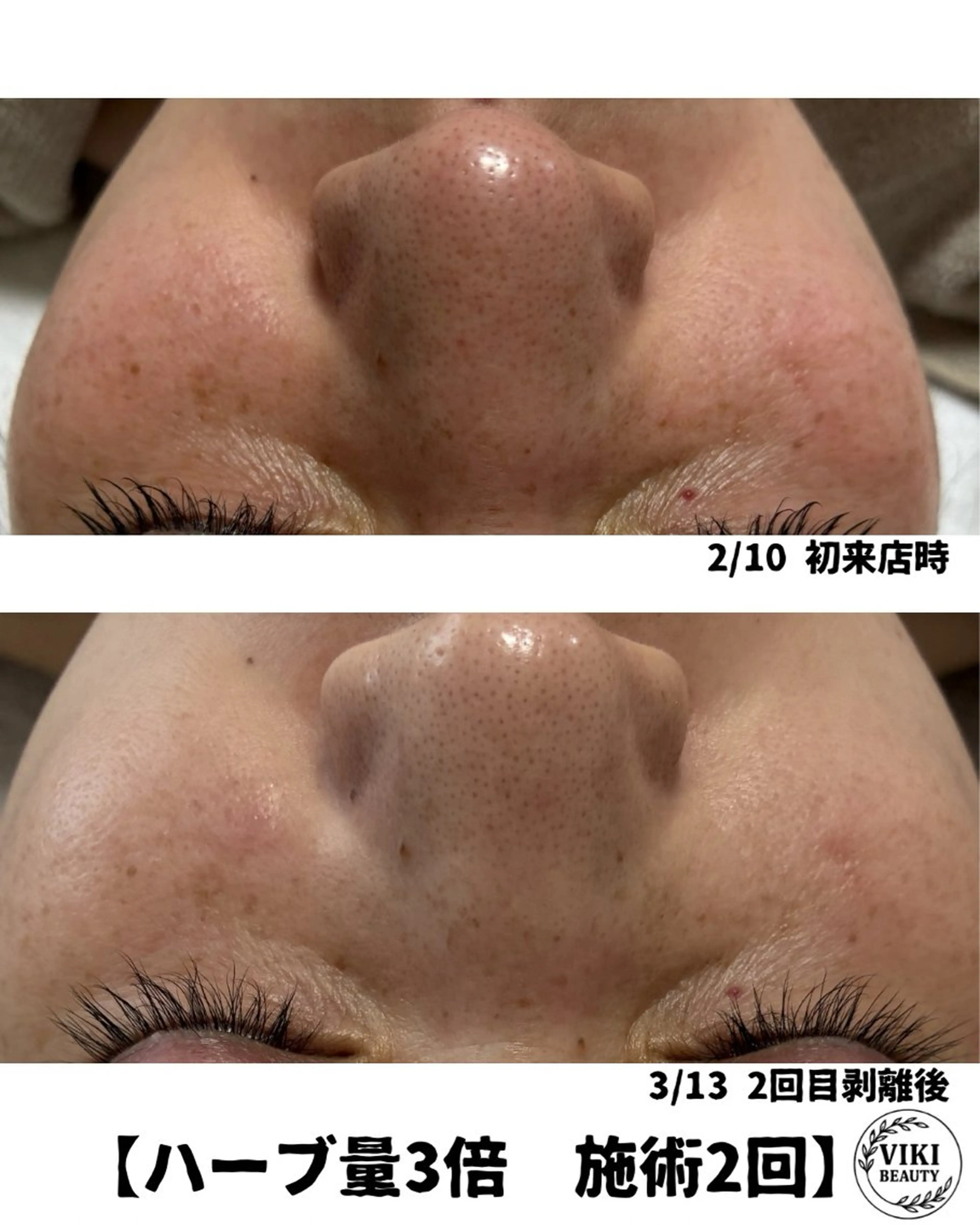 VIKI BEAUTYのエステ・リラクイメージ