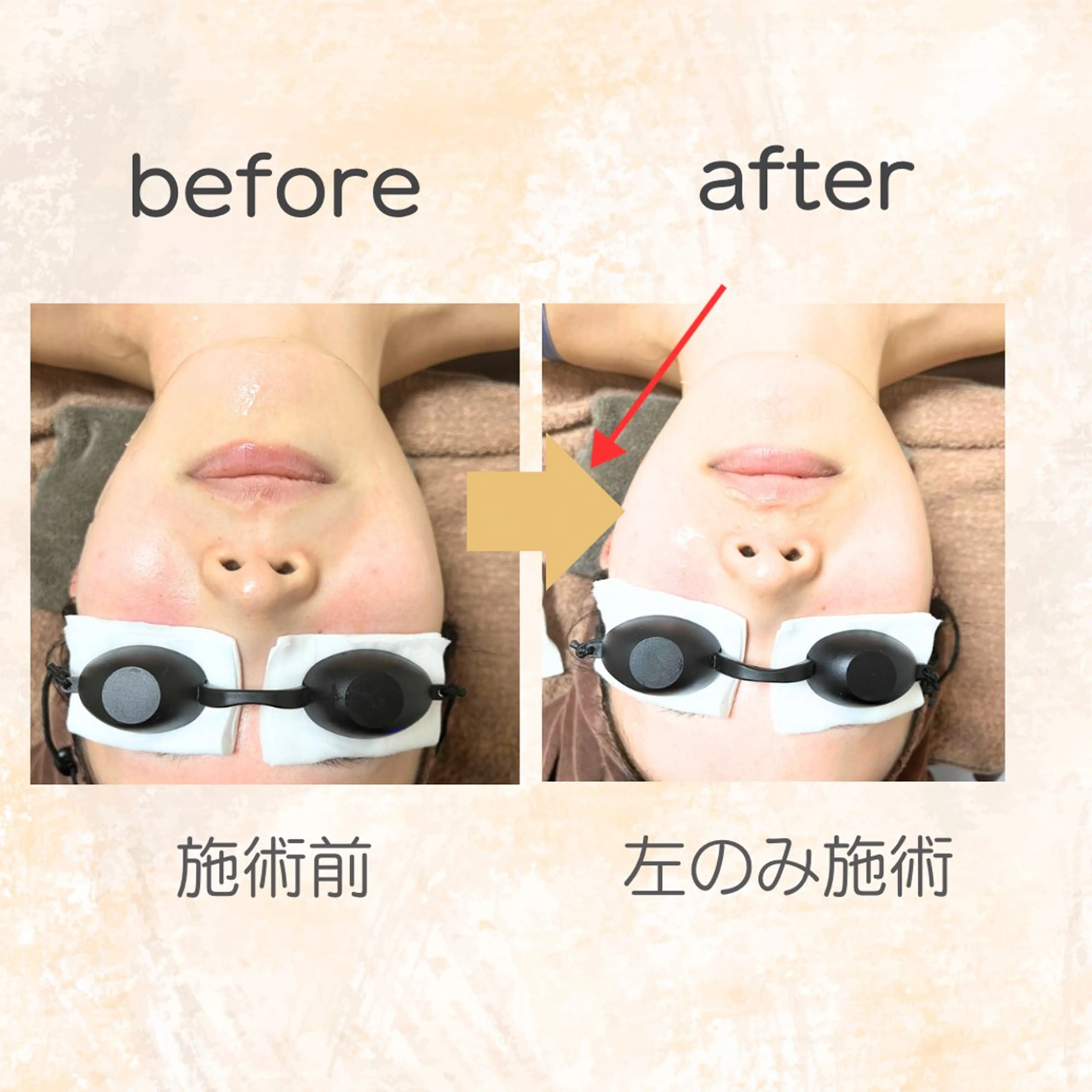 脱毛専門店 Angemのエステ・リラクイメージ