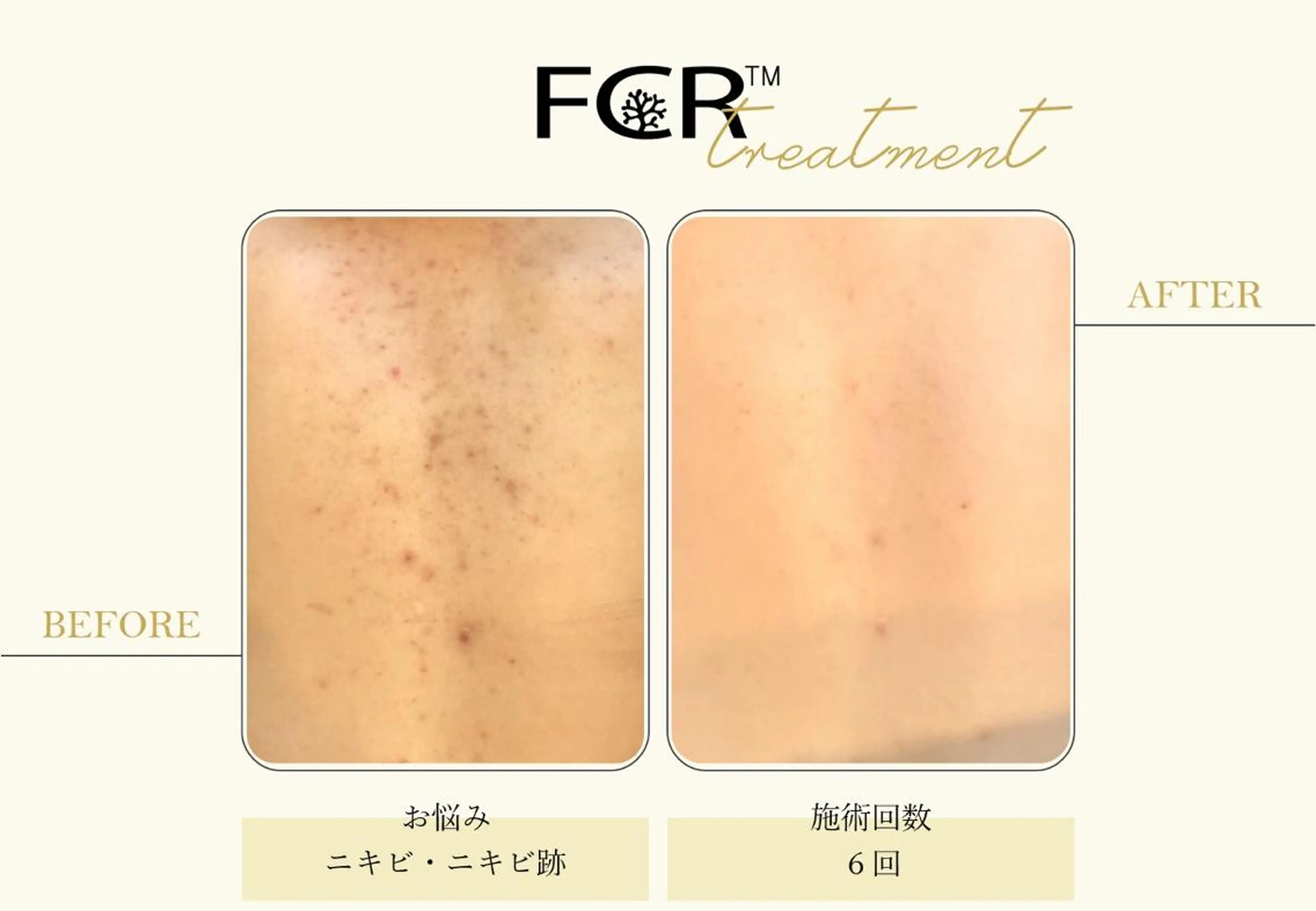 美容鍼灸/小顔鍼灸 肌質改善エステのエステ・リラクイメージ