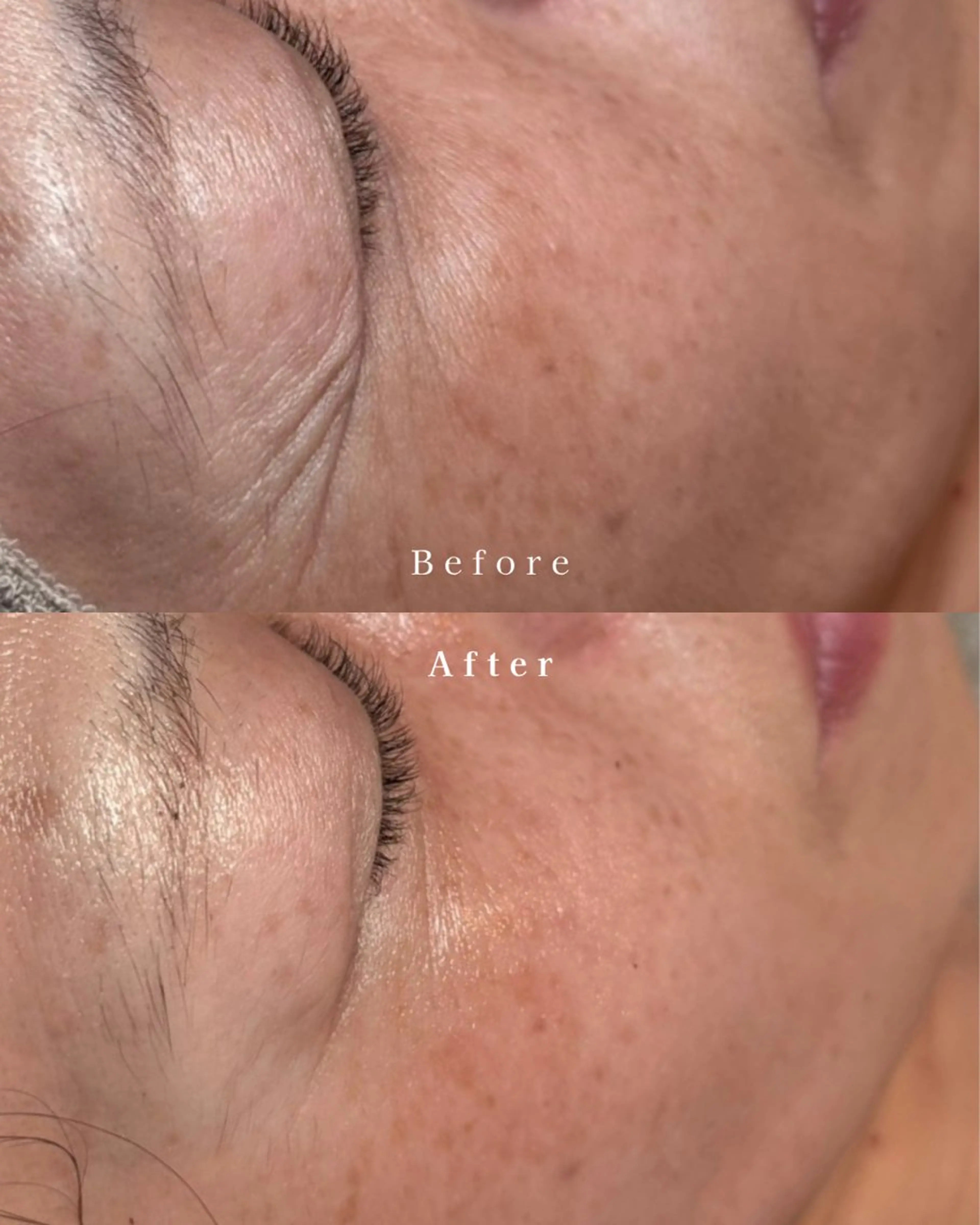 肌質改善| Rootree Miのエステ・リラクイメージ