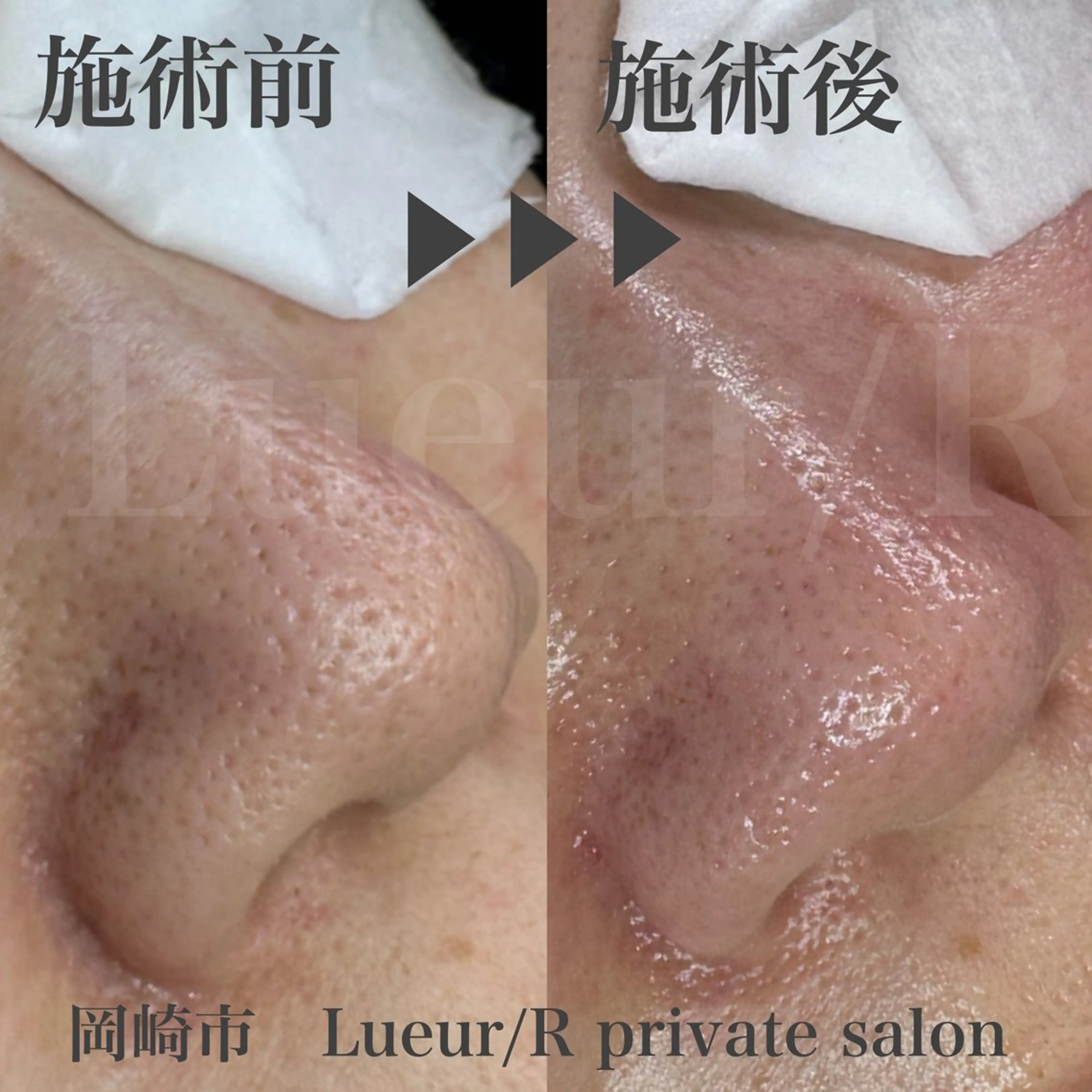 エステ 大久保 里奈のエステ・リラクイメージ