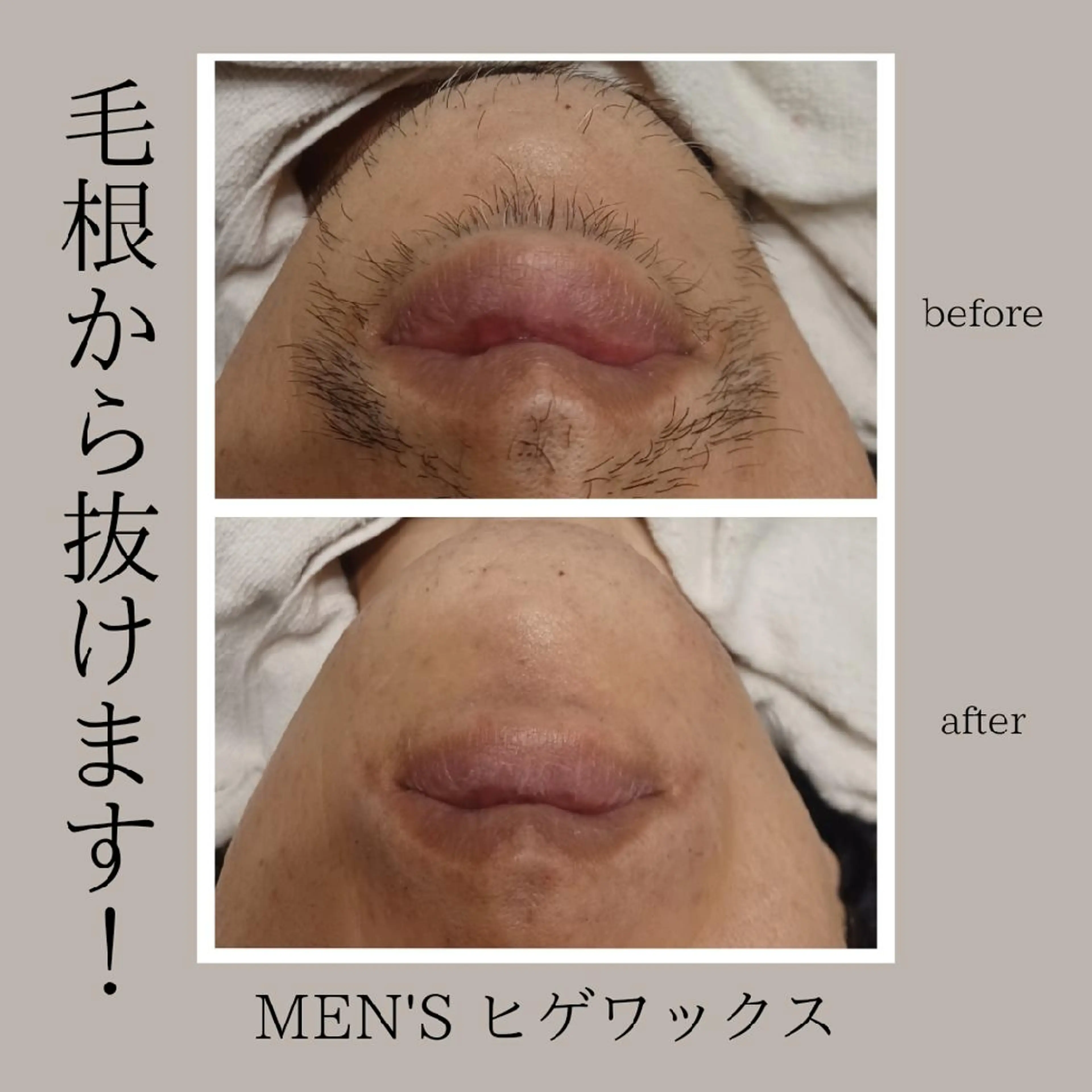 メンズ Lutella所属・ワックス脱毛専門店 Lutellaのエステ・リラクイメージ