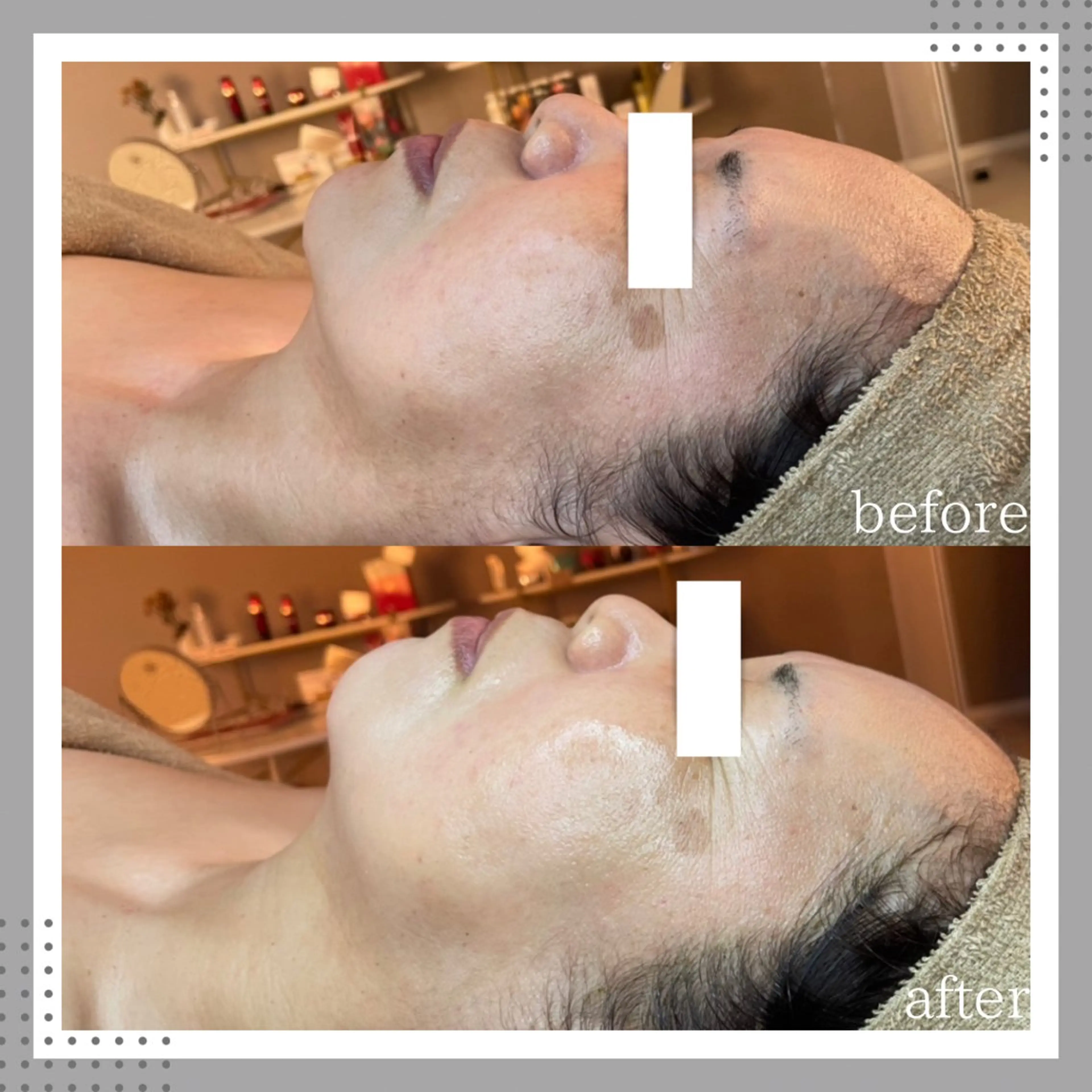 エステ amber(アンバー)所属・プライベートサロン amberのエステ・リラクイメージ