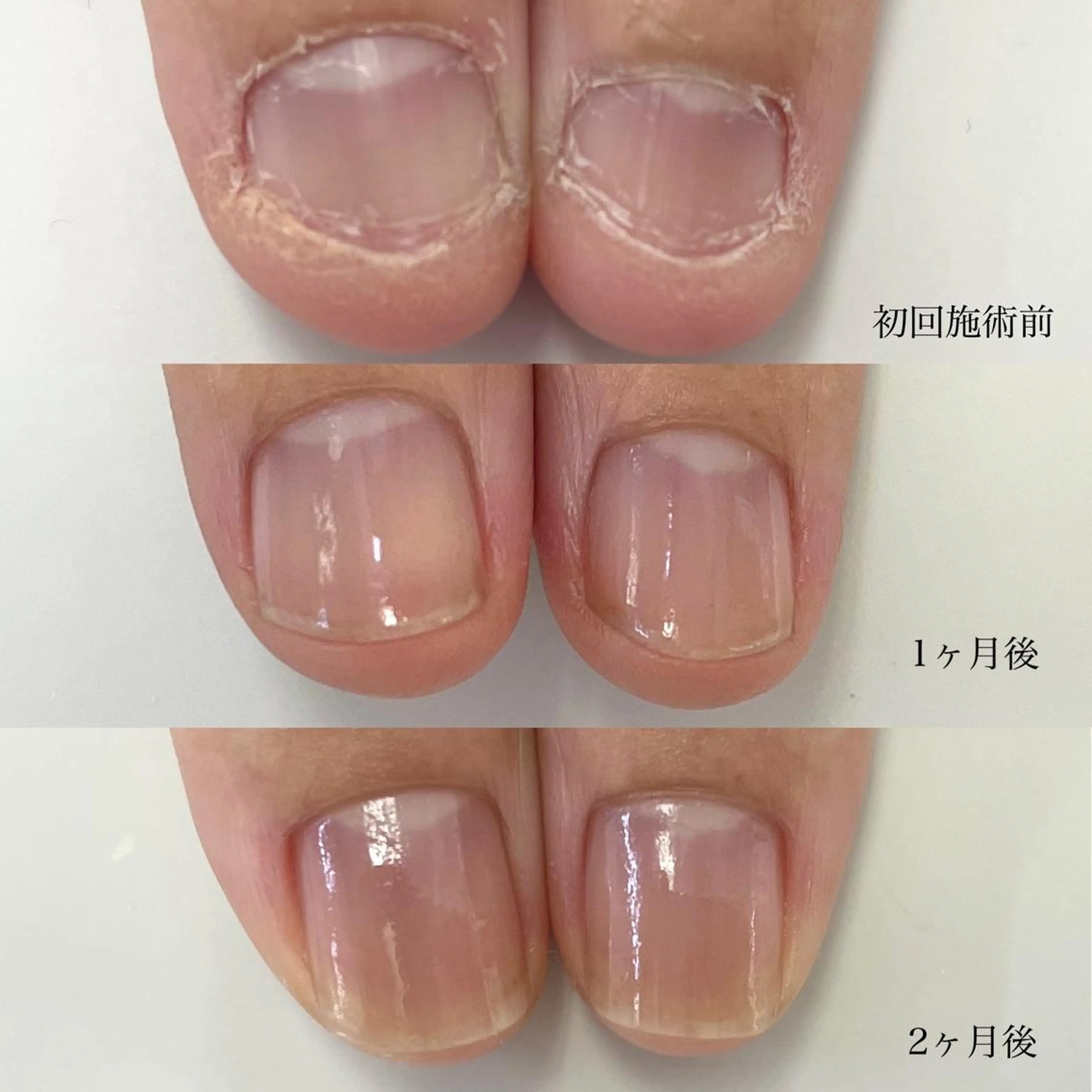 ネイル TiALASH ＊Kozue＊のネイルデザイン