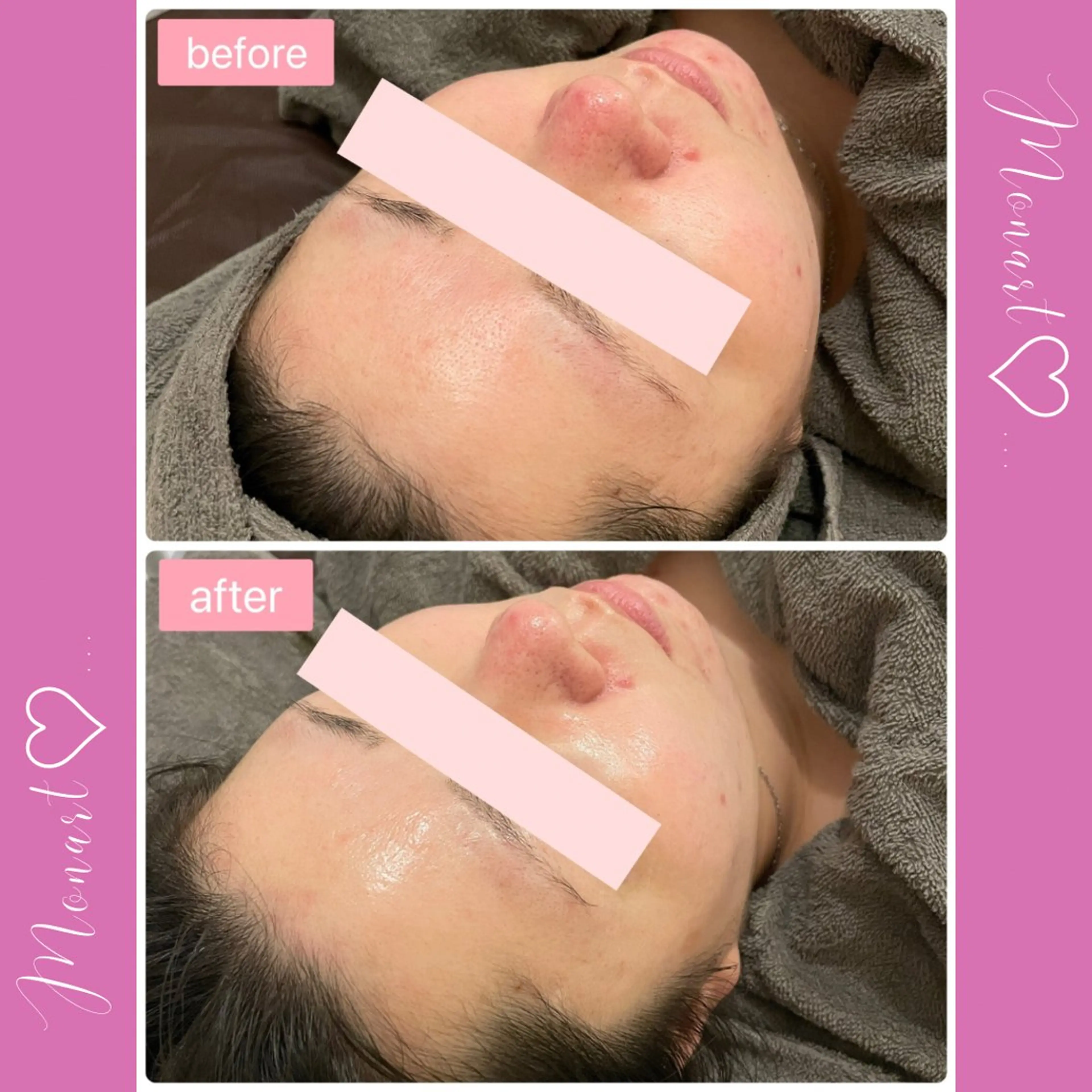 Monart -deux-のエステ・リラクイメージ