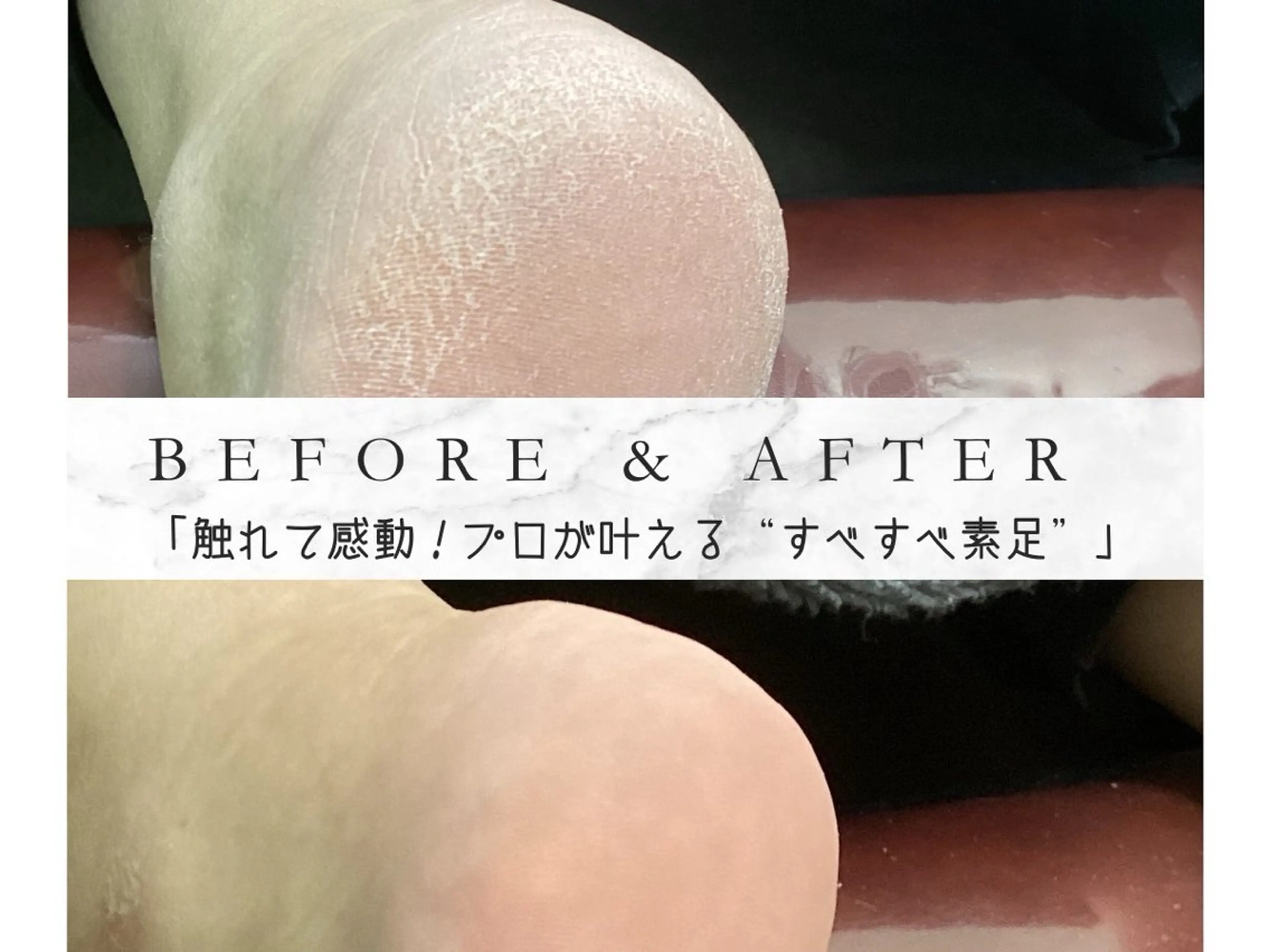 リラク ヒューマン 鍼灸接骨院所属・リラク/ネイル/ 足裏ケア/蛭川栞のエステ・リラクイメージ