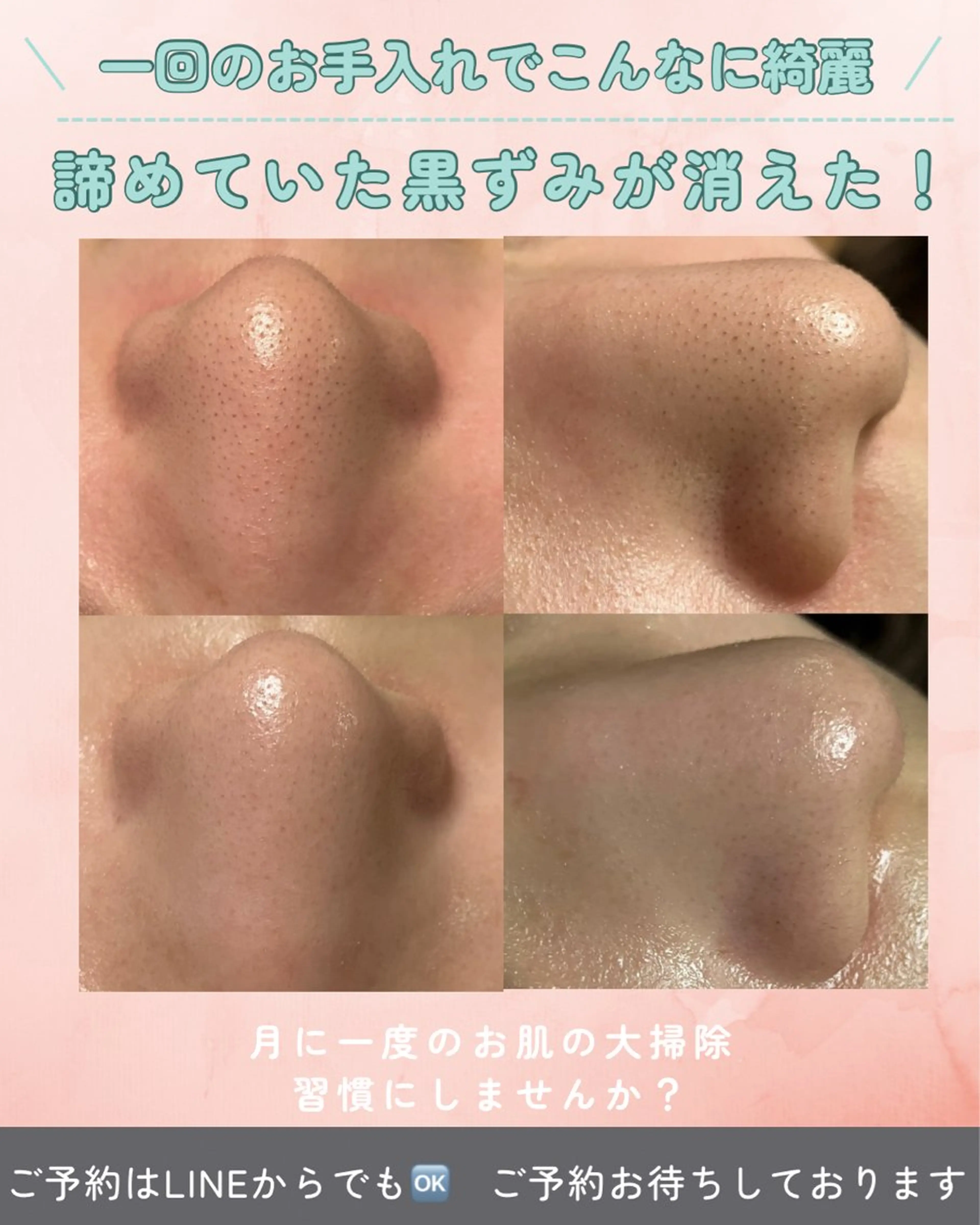 パラ・ ディのエステ・リラクイメージ