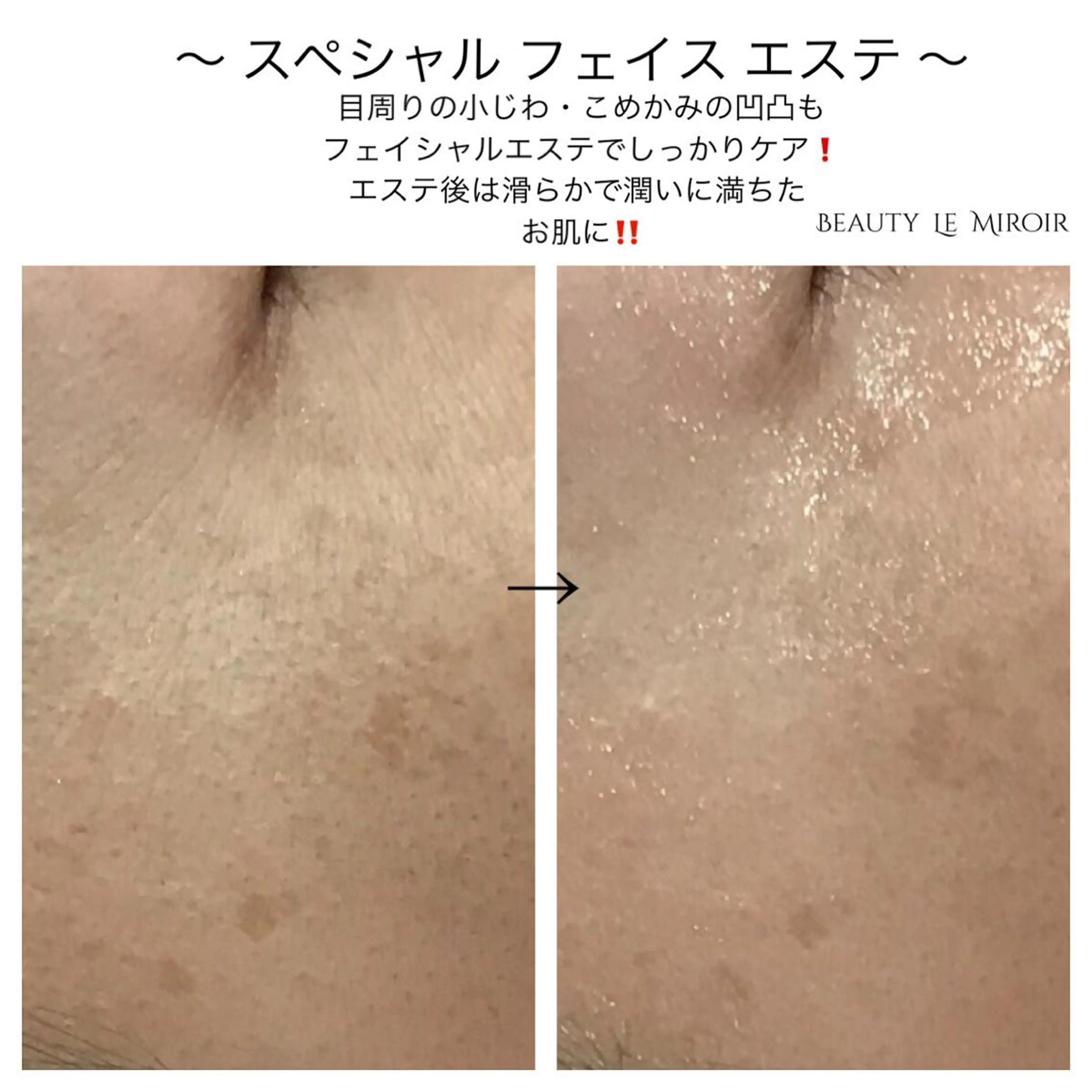 ビューティー ミロワールのエステ・リラクイメージ