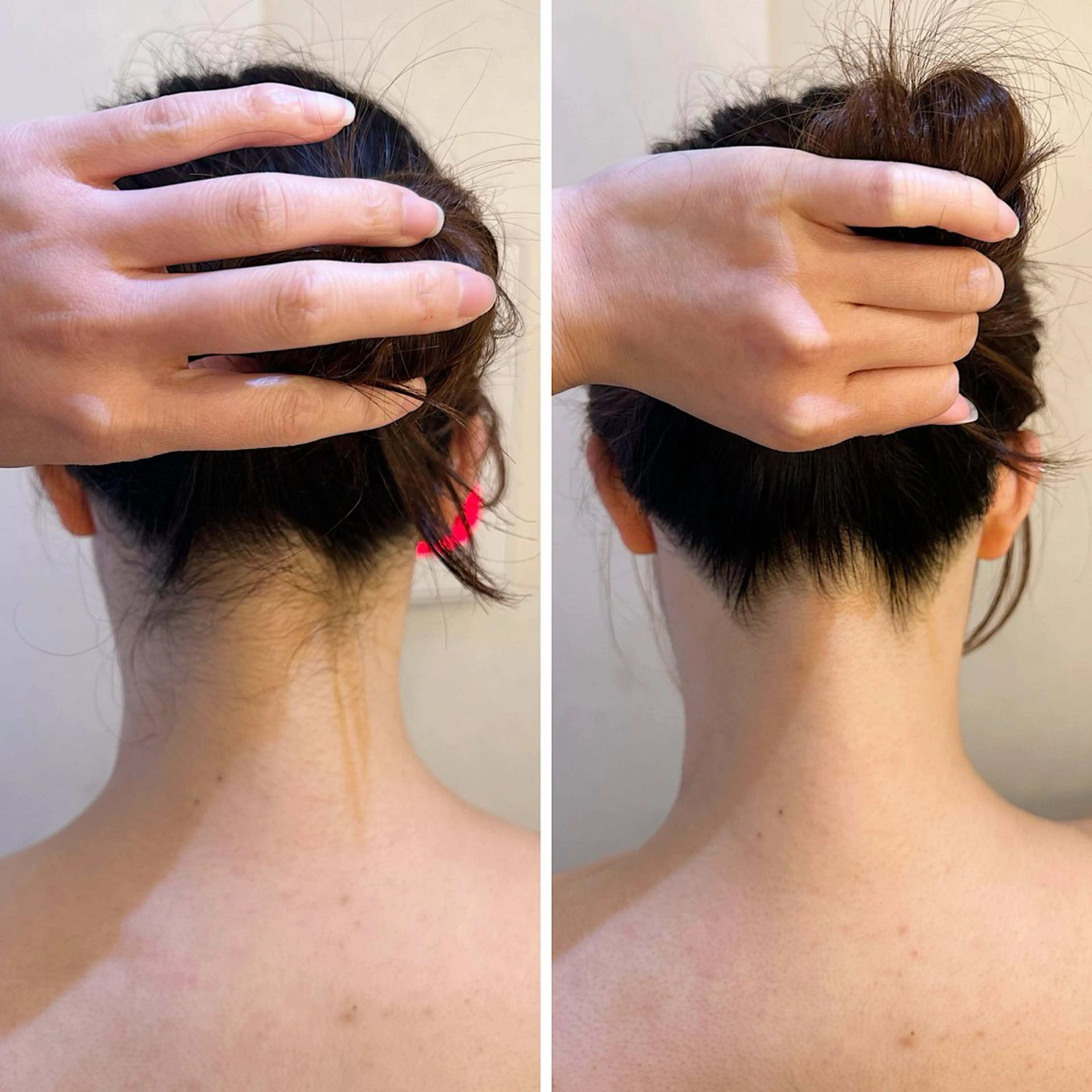 脱毛 うなじ脱毛/美肌脱毛 LABELのエステ・リラクイメージ