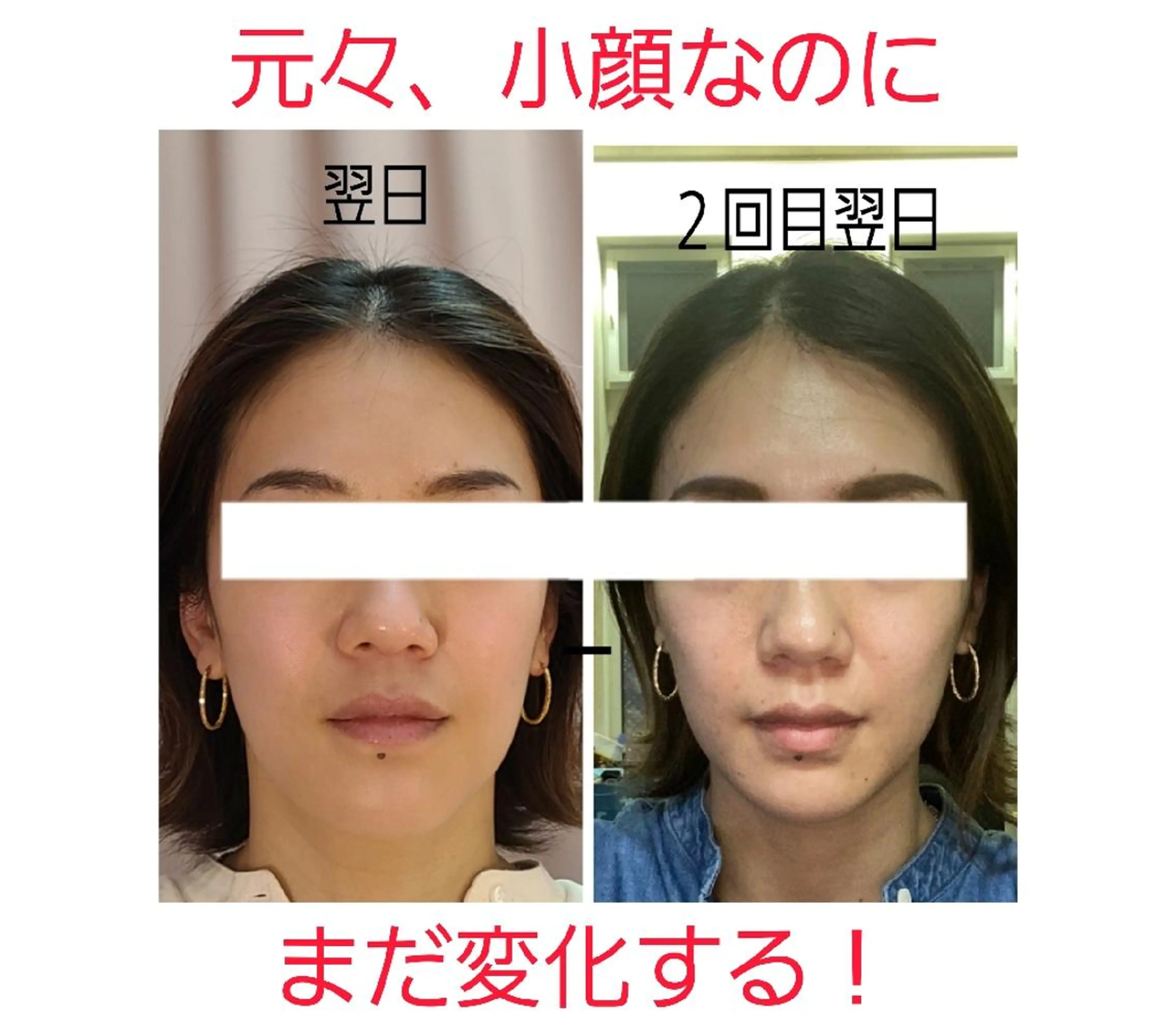 エステ 小顔 美肌専門 Matoriaのエステ・リラクイメージ