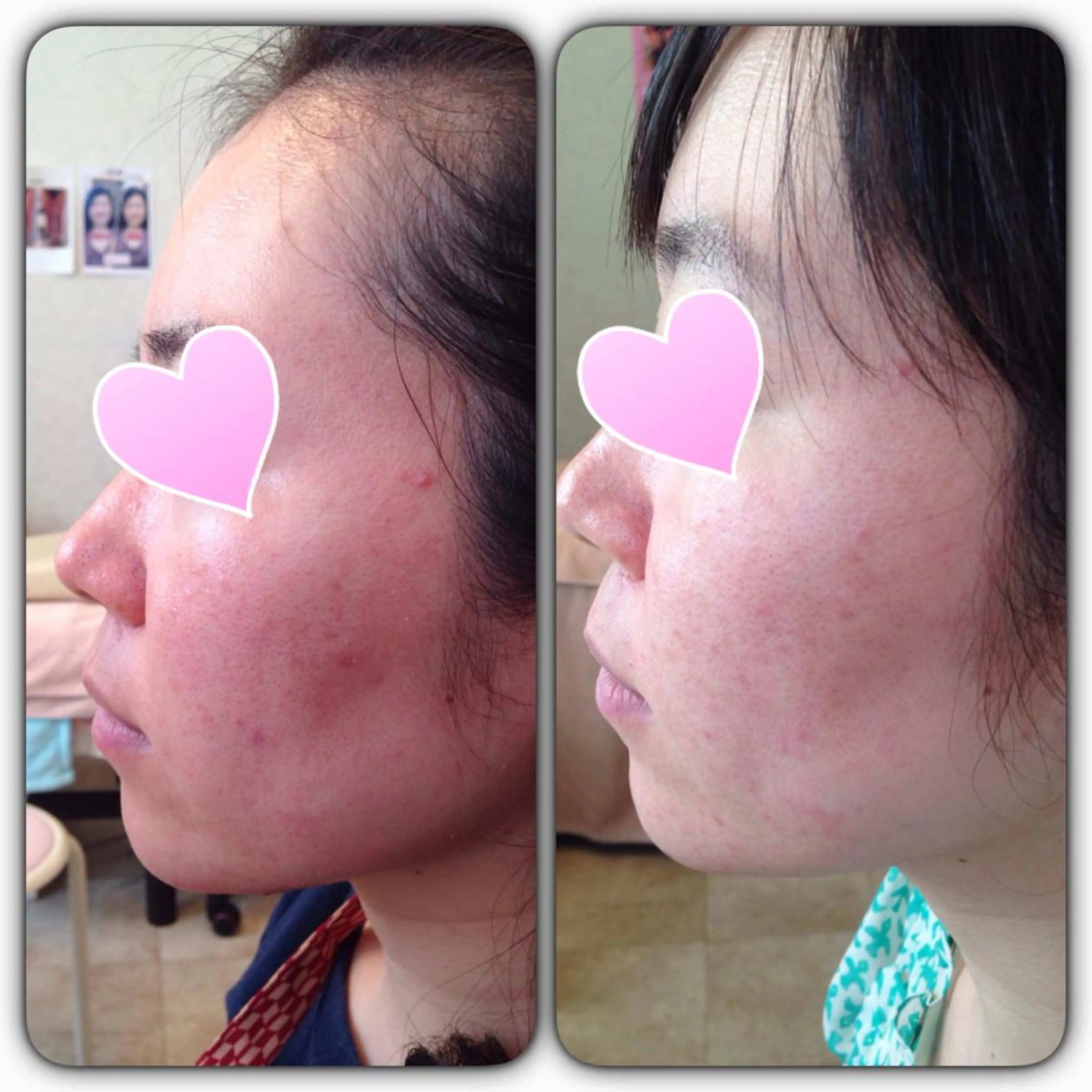 フェイシャルワックス 自然派エステファーノのその他イメージ