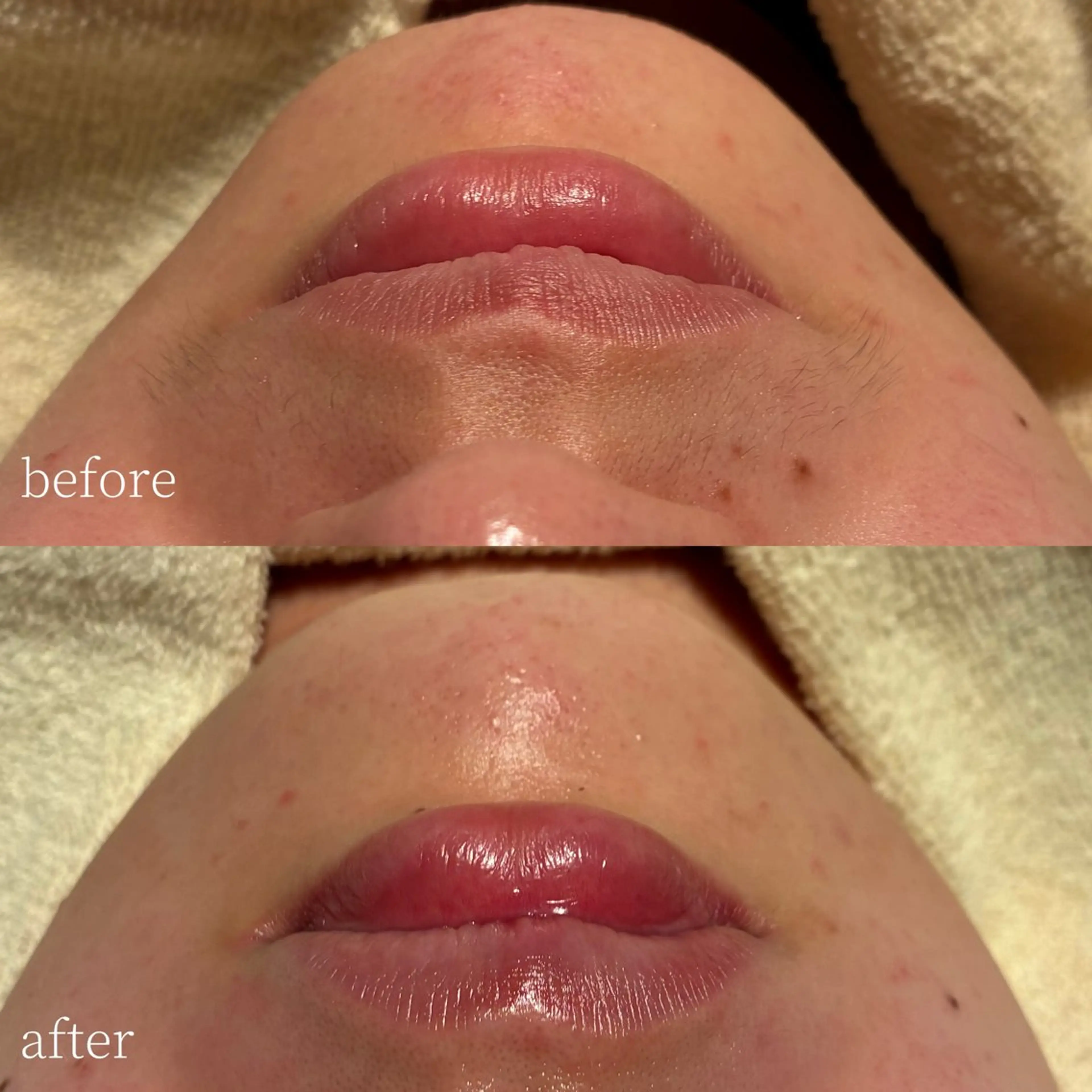 脱毛 Erika komorebi_のエステ・リラクイメージ