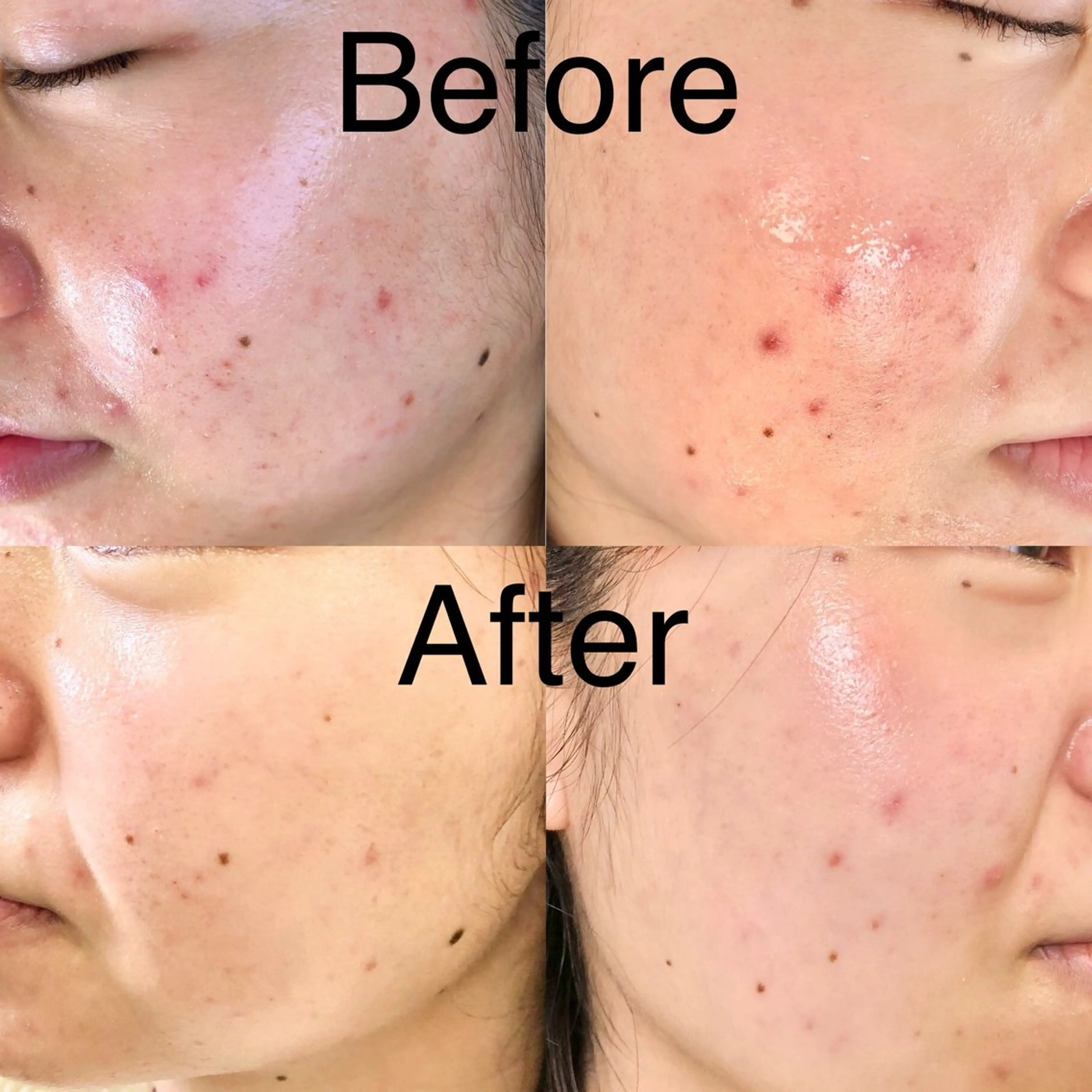 エステ Ideal Me 春内茉那の眉毛・アイブロウイメージ