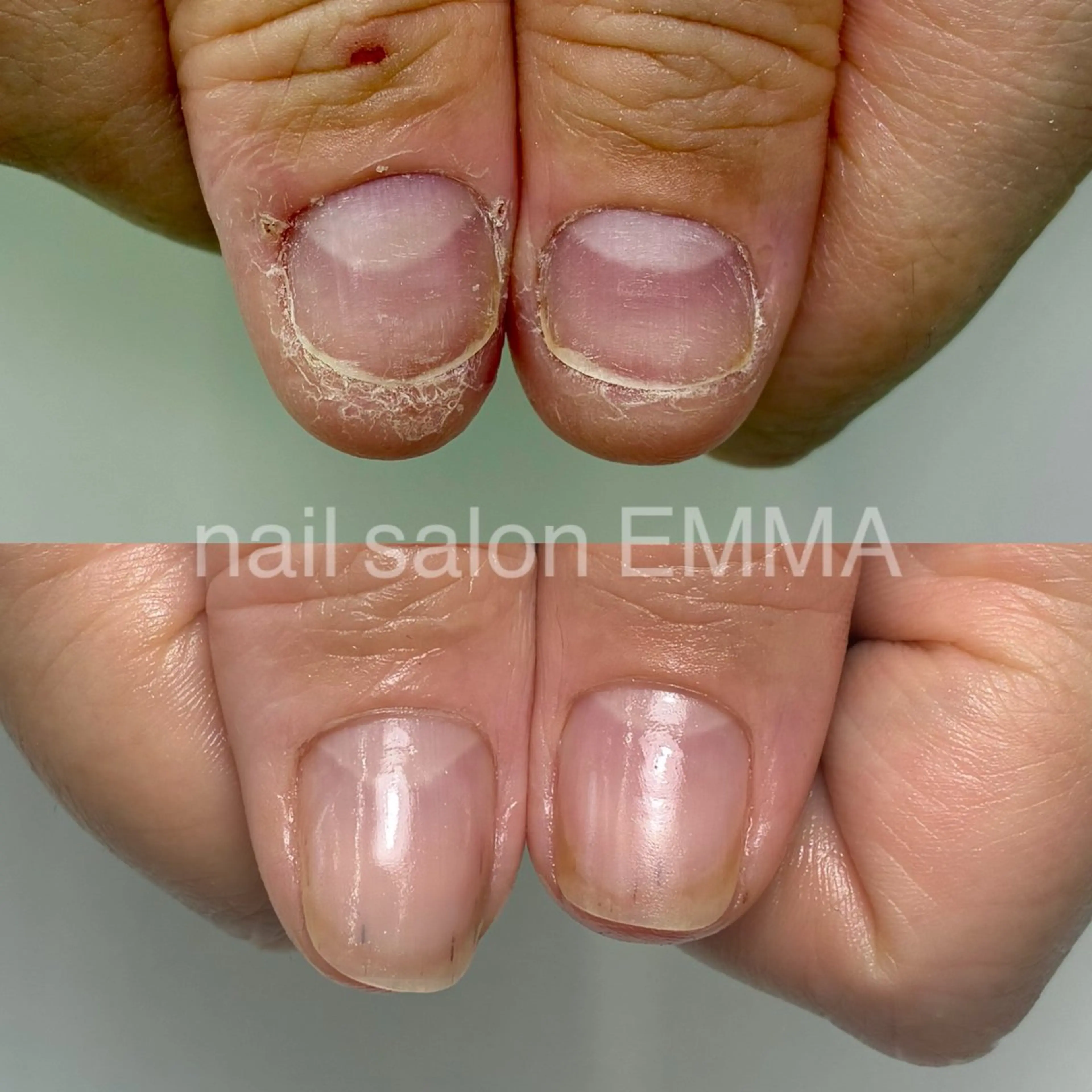 ネイル 広島市南区(広島県) /深爪/自爪育成のネイルデザイン