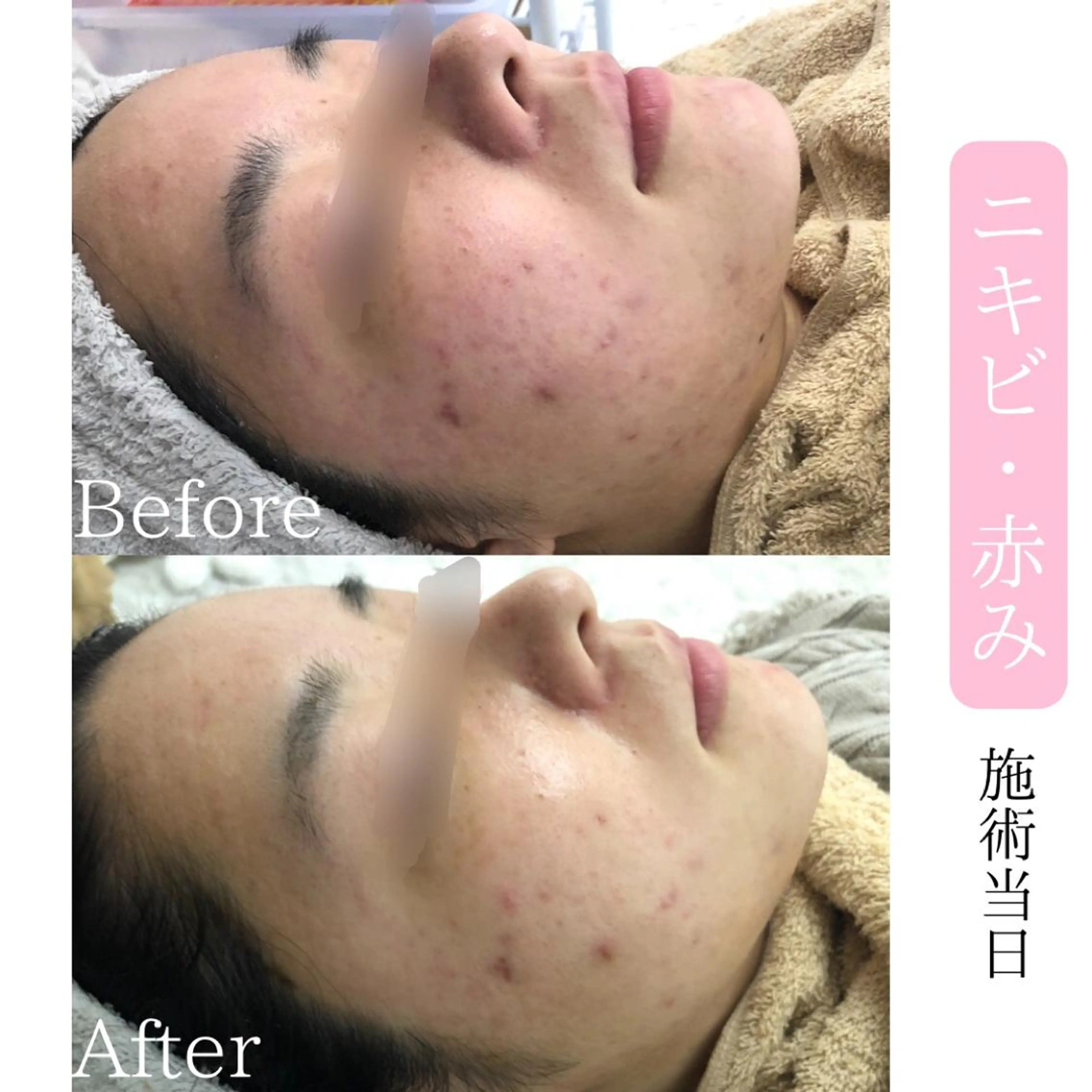 肌質改善サロン BestBelleのエステ・リラクイメージ