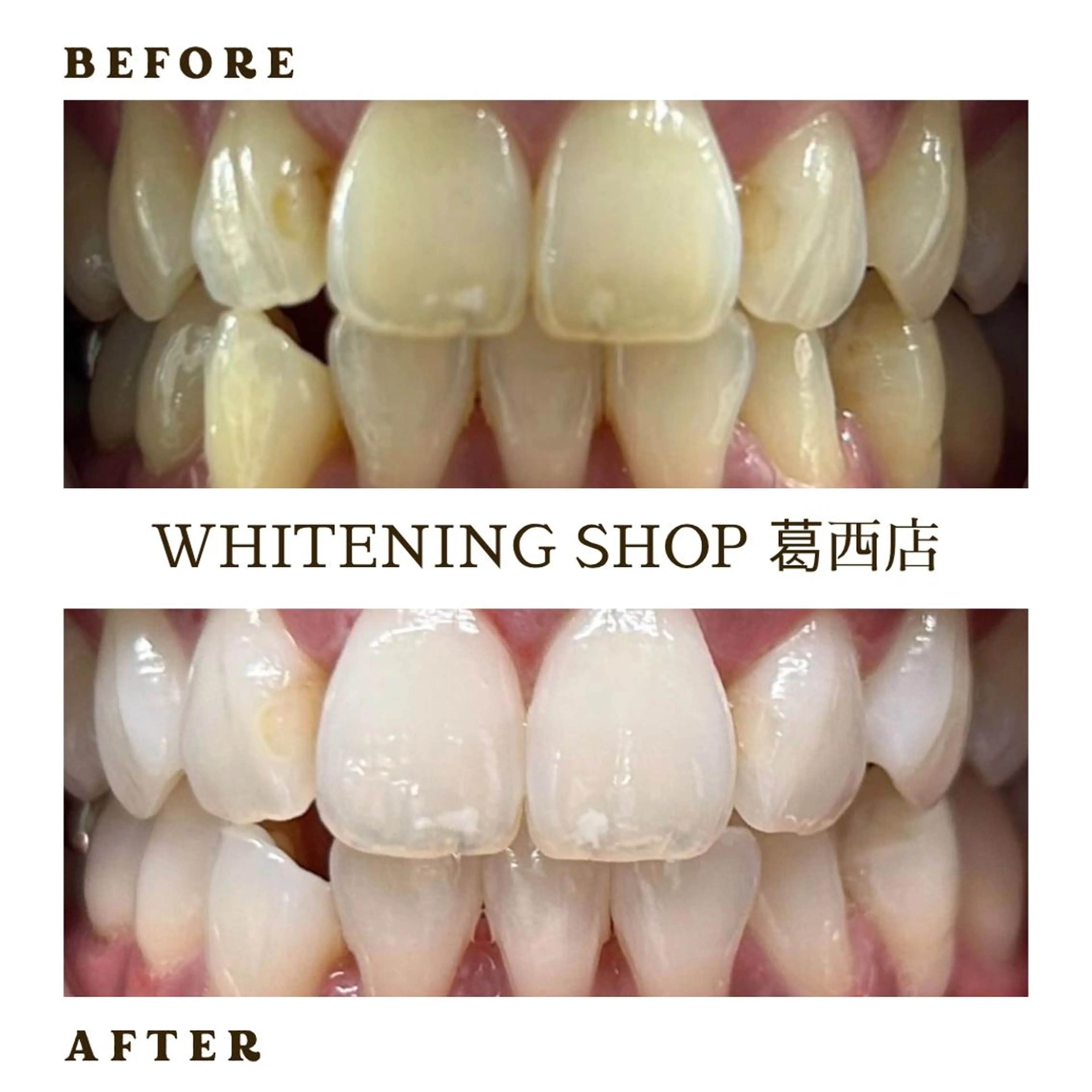 メンズ その他 ホワイトニング ショップ葛西店のその他イメージ