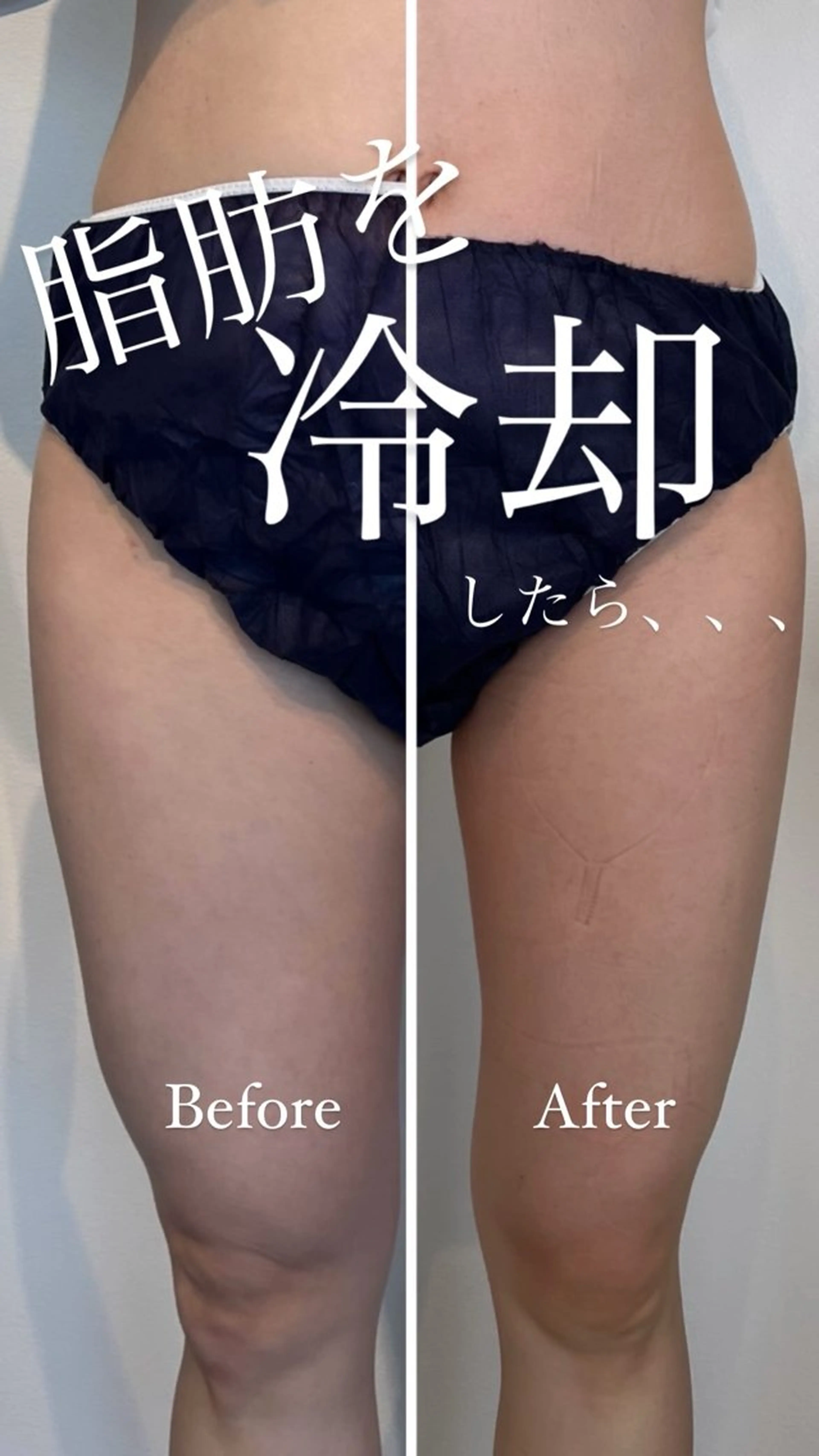 エステ 綺麗のひみつ グランプリ受賞店のエステ・リラクイメージ