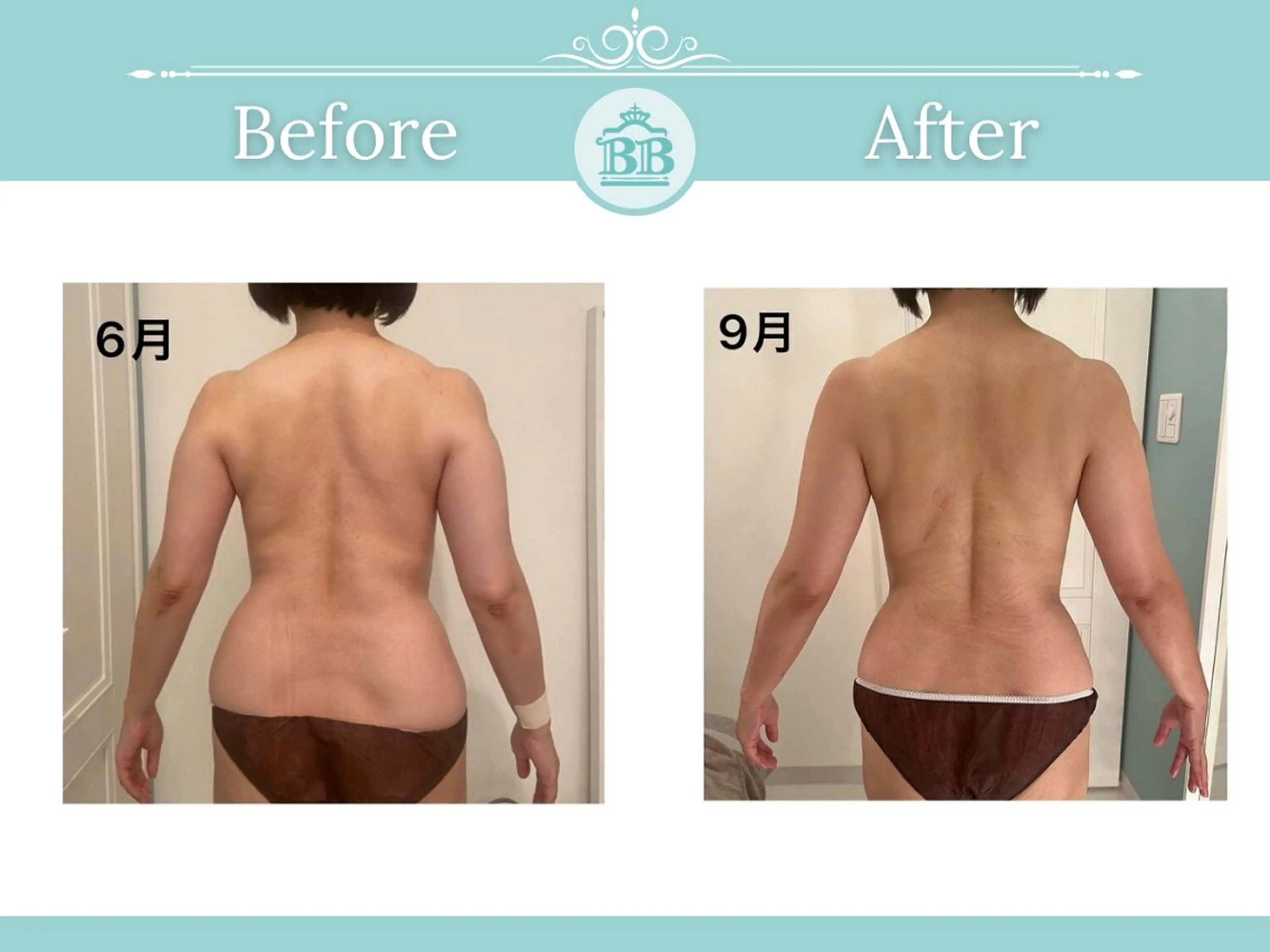 【全身痩身】バストを残してダイエット(機械付)⚫︎60分※すぐ予約のみ【1日2名限定OPEN記念モニター様】の写真